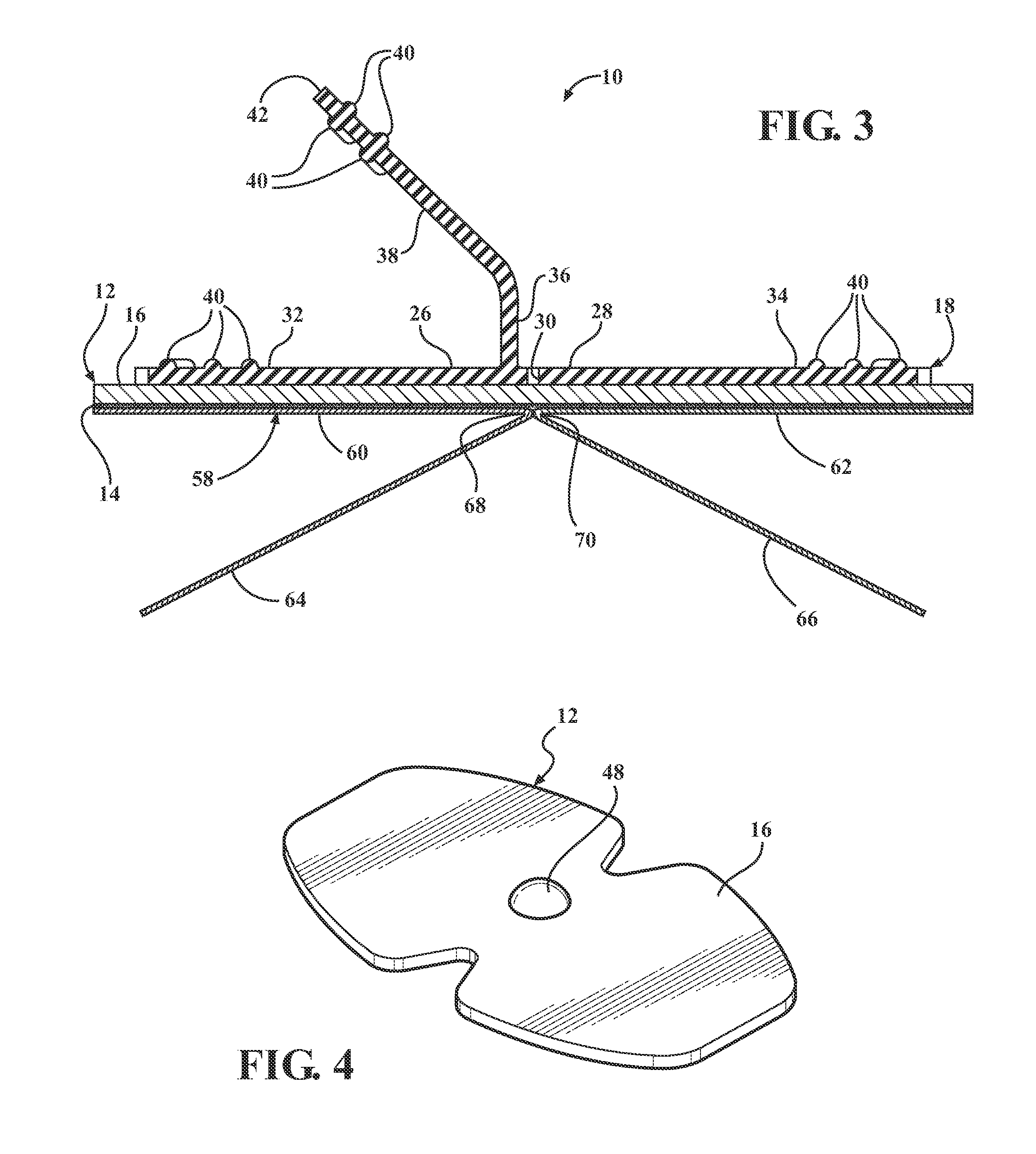 Specialized catheter securement devices for peripherally inserted central catheters