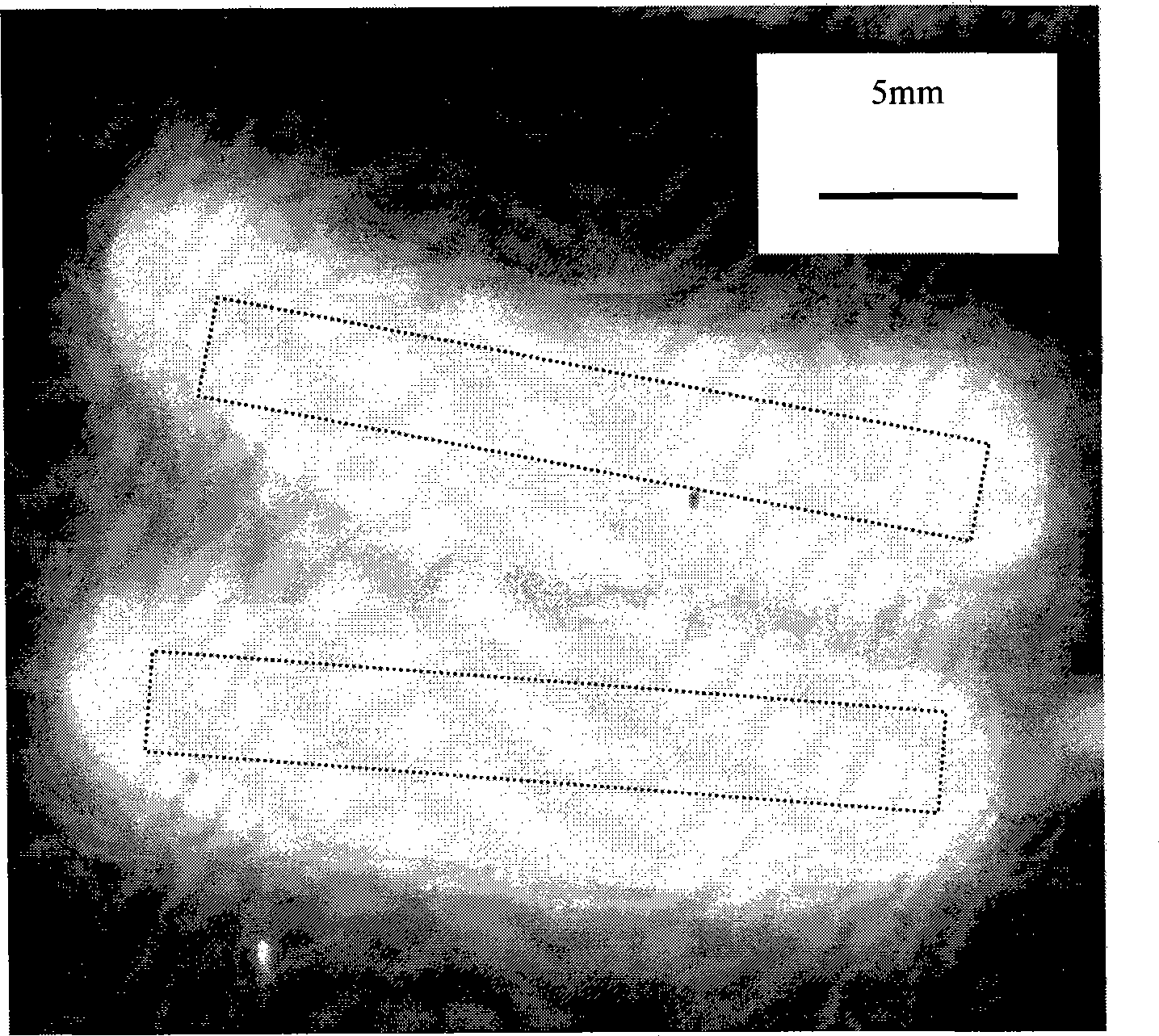 Method for TiNi alloy stent with phosphorus injection and slow neutron irradiation activation