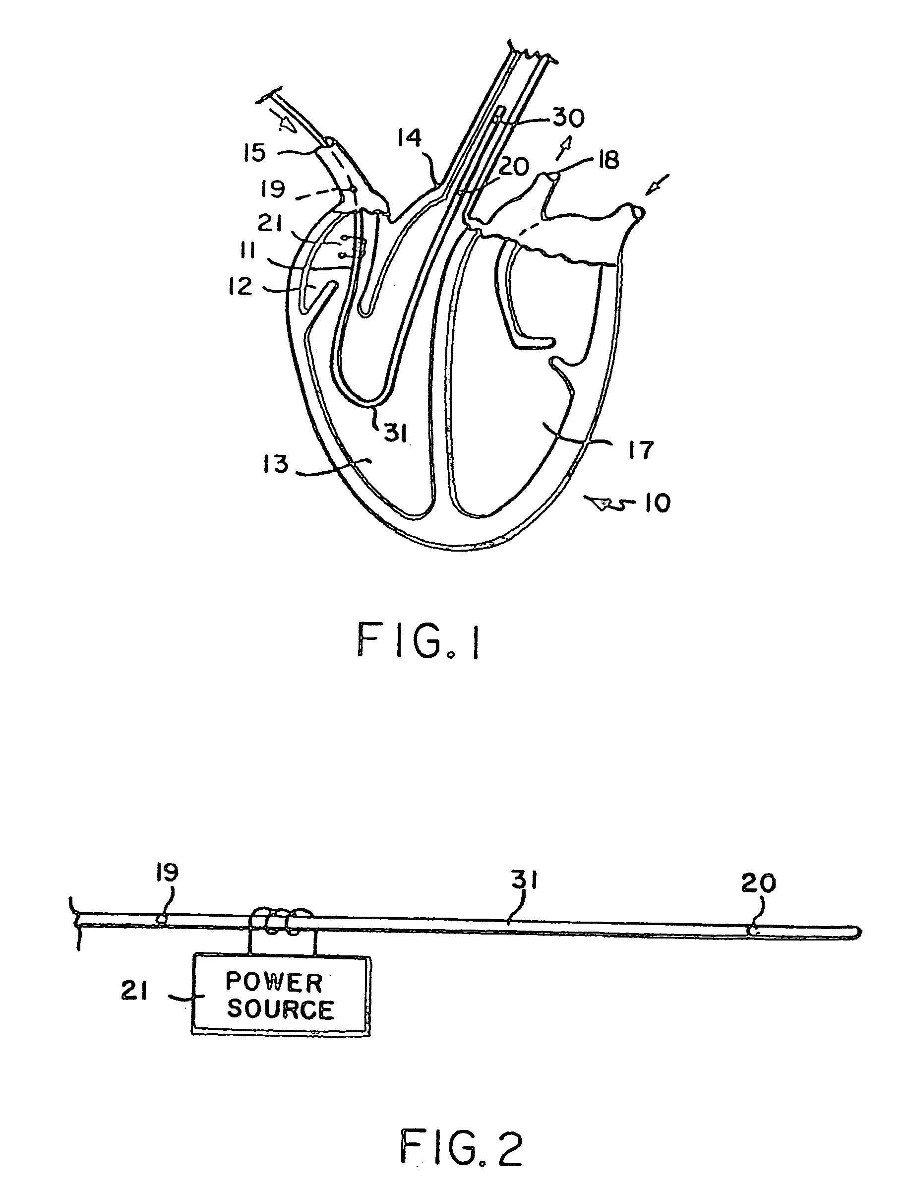 Blood flow monitor with venous and arterial sensors