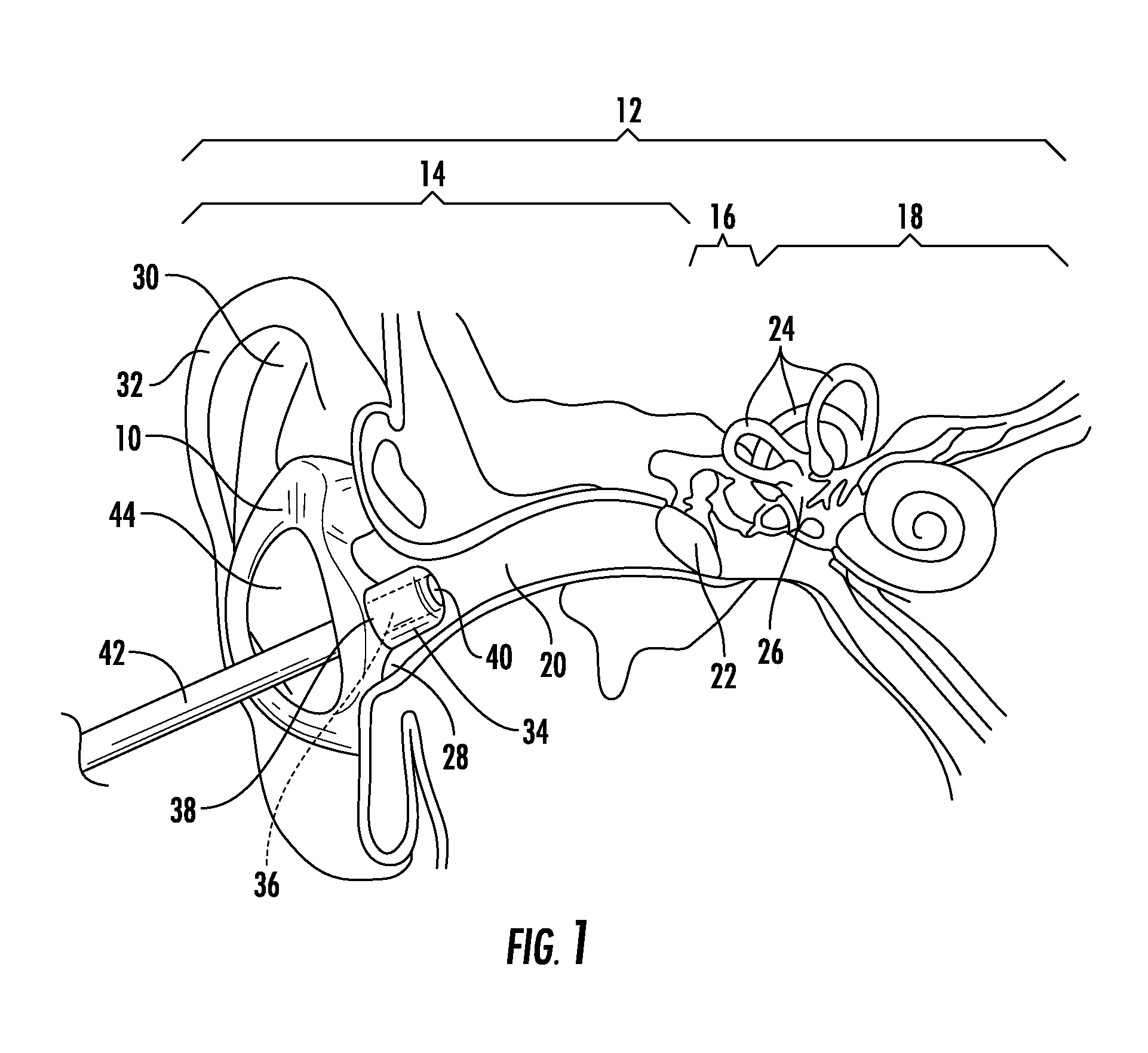 Apparatus for Preventing Motion Sickness and Related Method