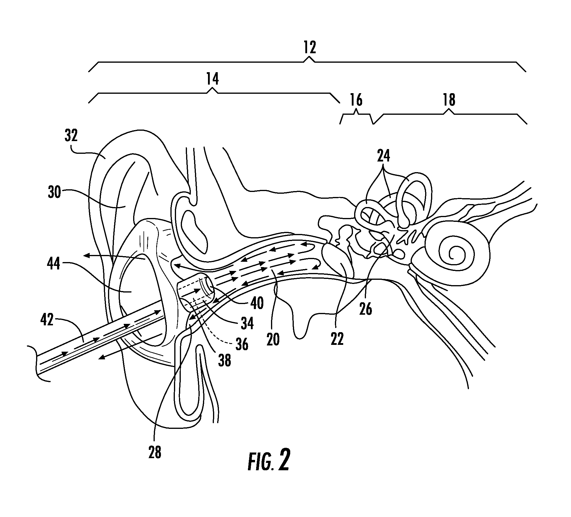 Apparatus for Preventing Motion Sickness and Related Method