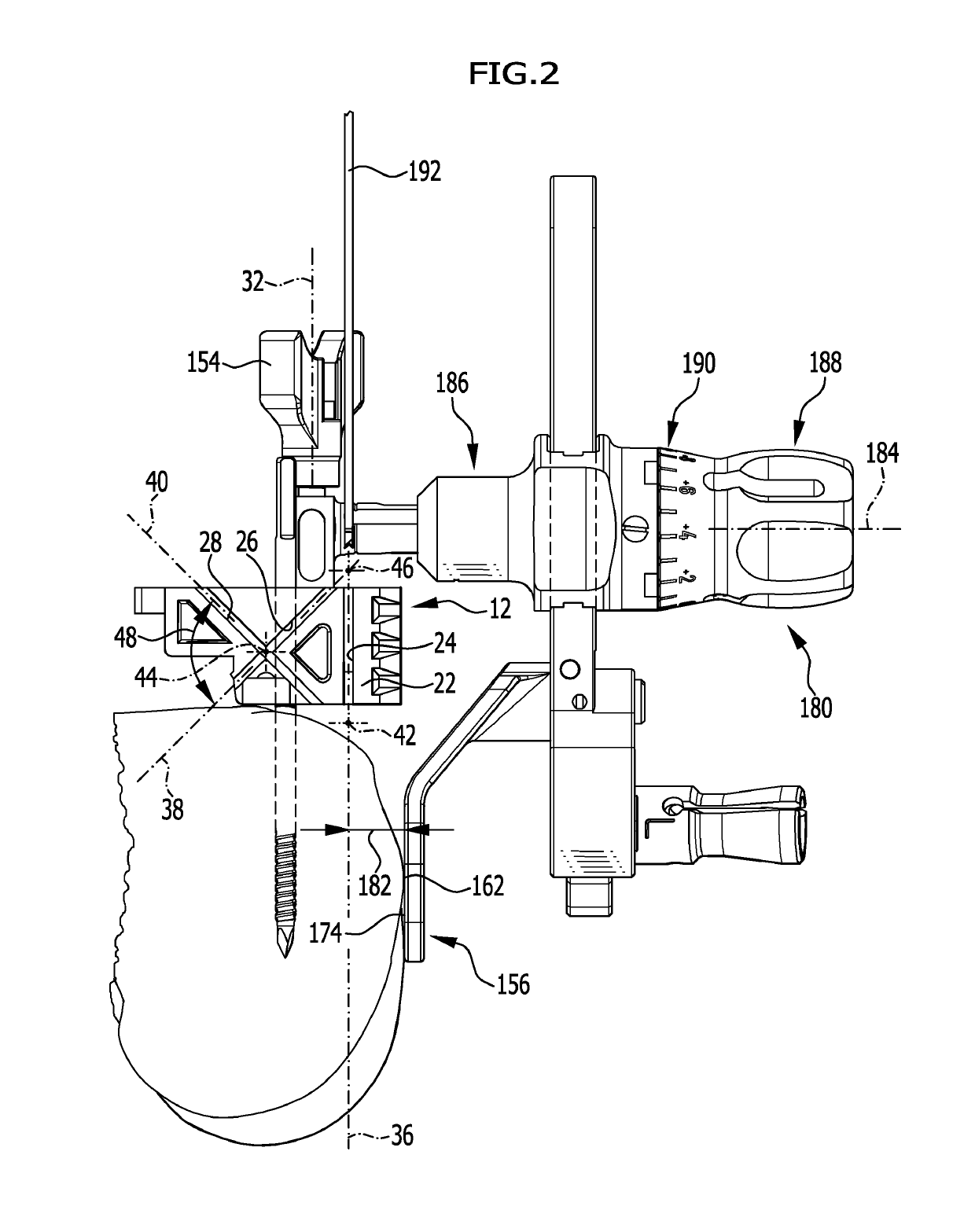 Surgical instrumentarium