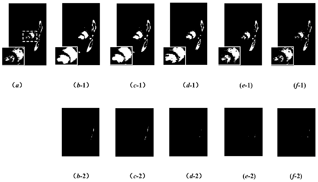 Dynamic magnetic resonance image reconstruction method based on improved robust tensor principal component analysis