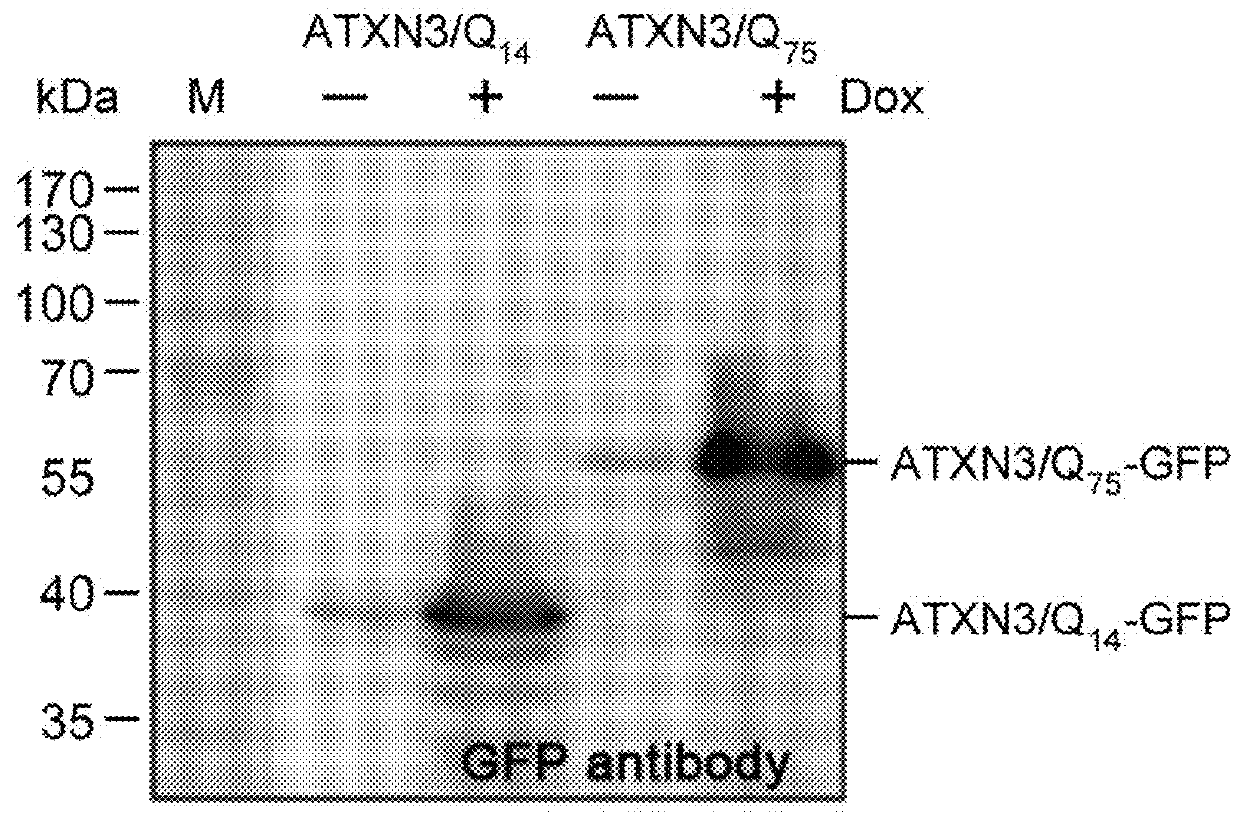 NiSOD-like compound and its derivatives for suppressing abnormal protein aggregation, recovering cell viability, increasing mature neuron number and neurite outgrowth length and protecting dopaminergic cells by reducing oxidative stress or reactive oxygen species in brain tissues