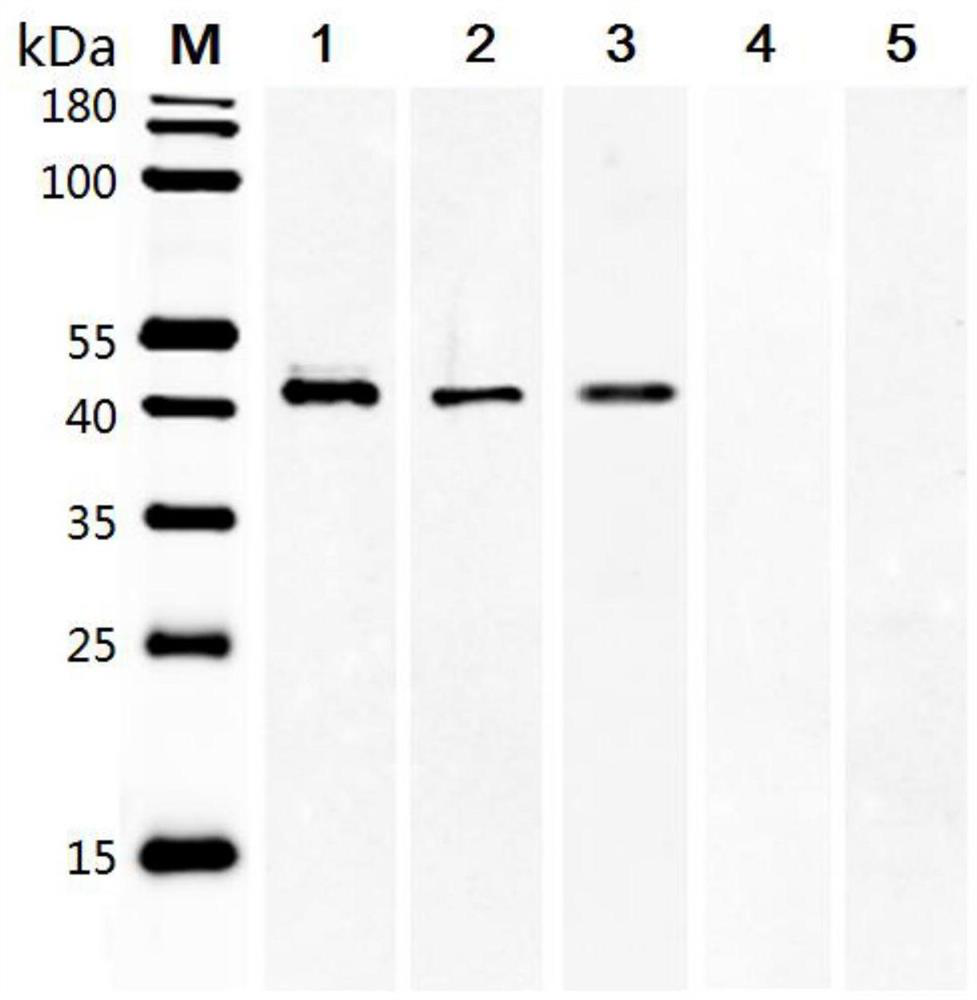 Schistosoma mansoni recombinant fusion protein SmSAP and application thereof to schistosomiasis immunodiagnosis