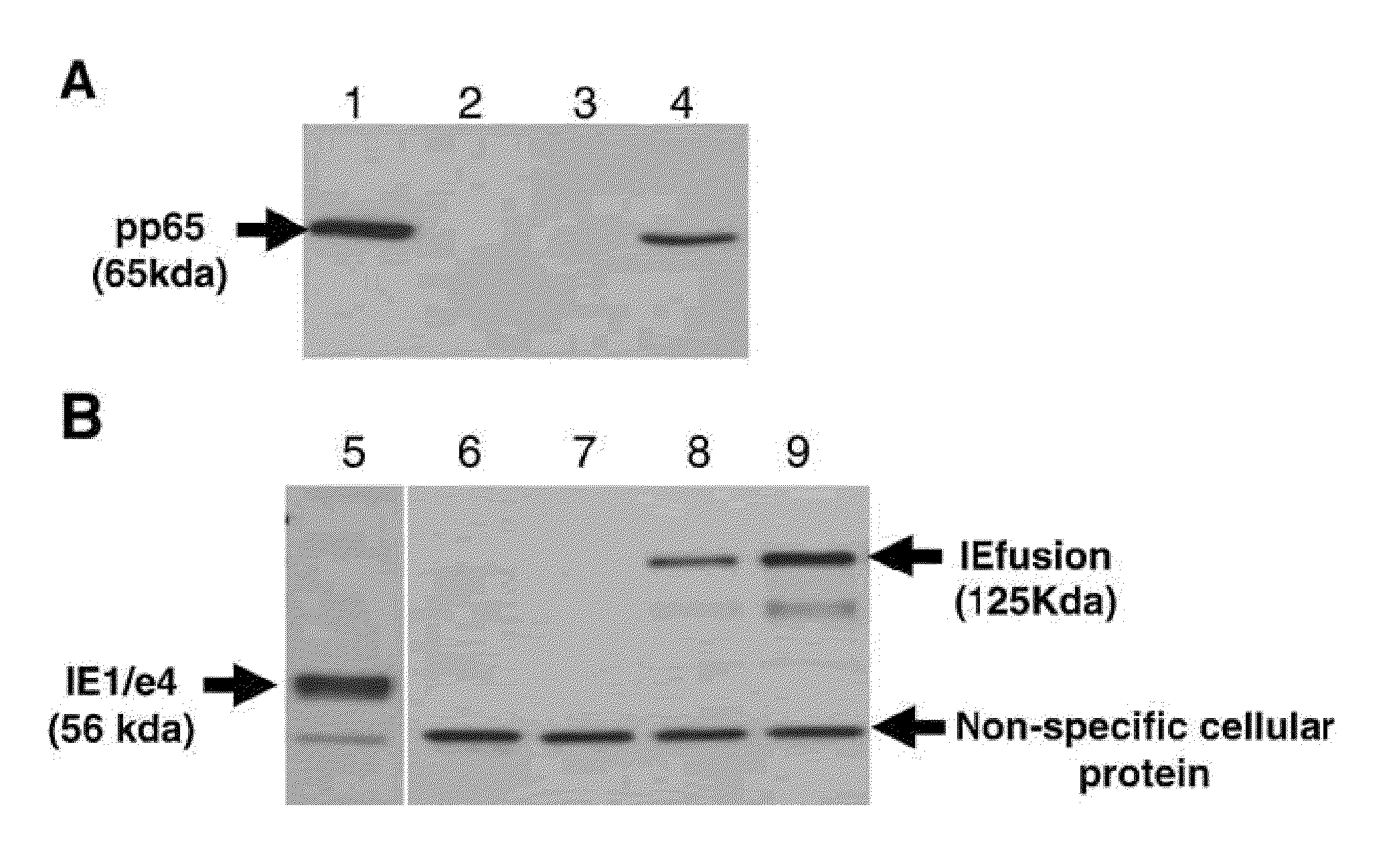 Genetically stable recombinant modified vaccinia ankara (RMVA) vaccines and methods of preparation thereof