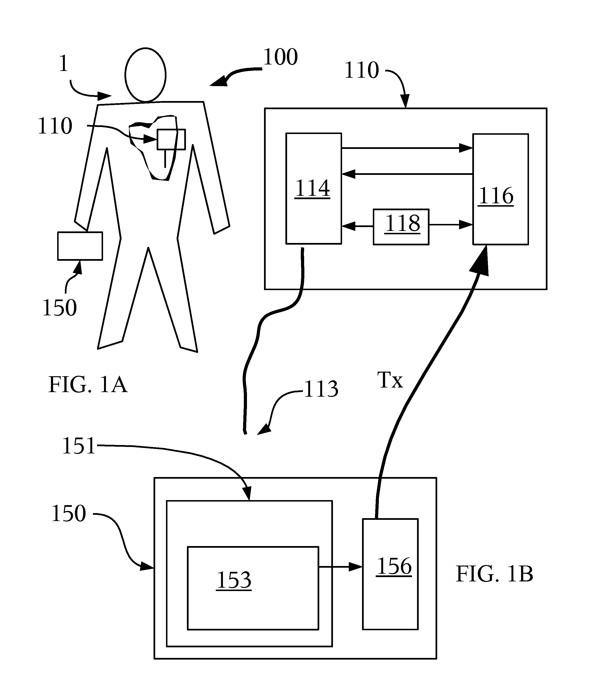 Method and Apparatus for Control of Pacemakers