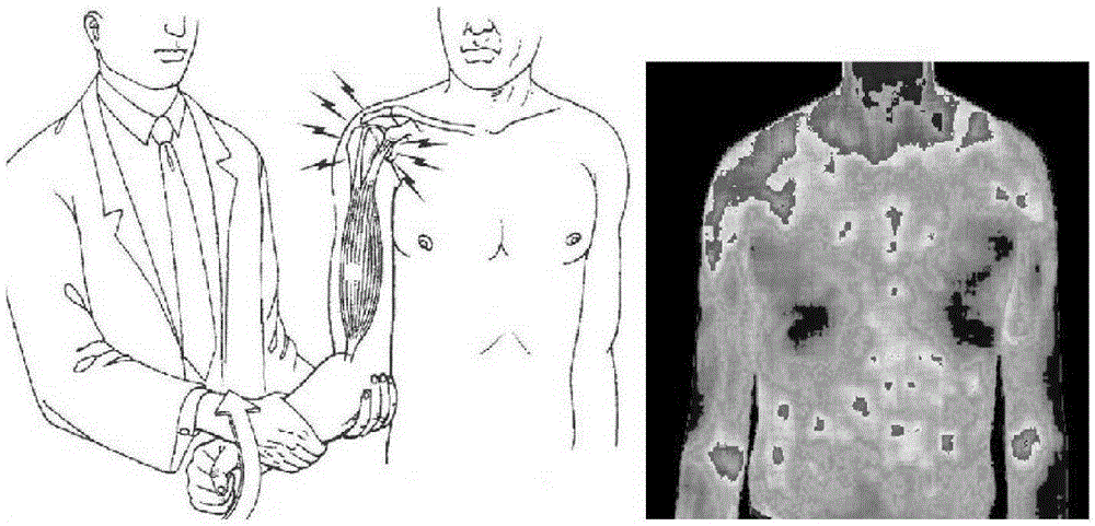 Medical auxiliary examination method, device and apparatus by medical infrared thermography for human bodies