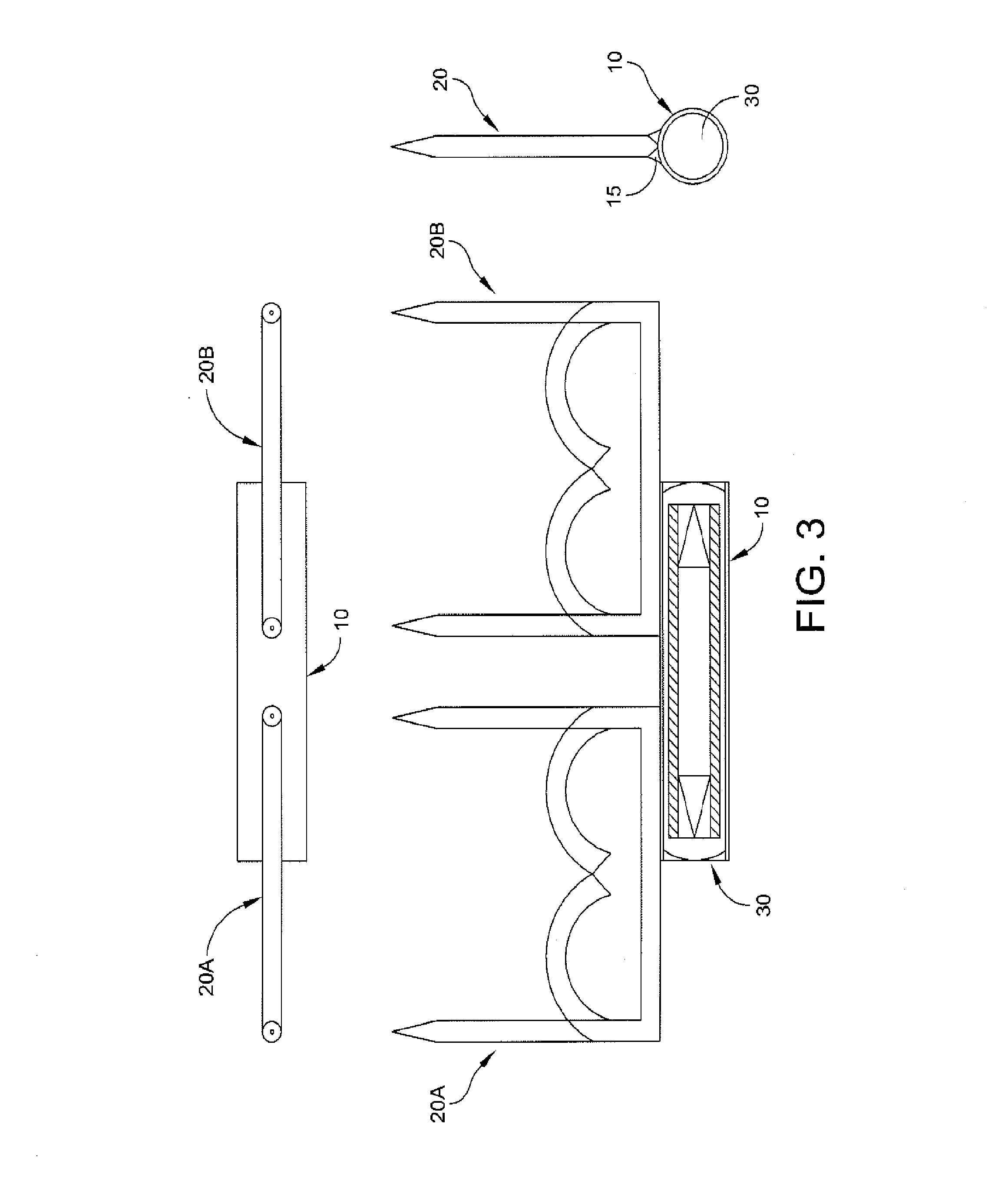 Delivery applicator for radioactive staples for brachytherapy medical treatment