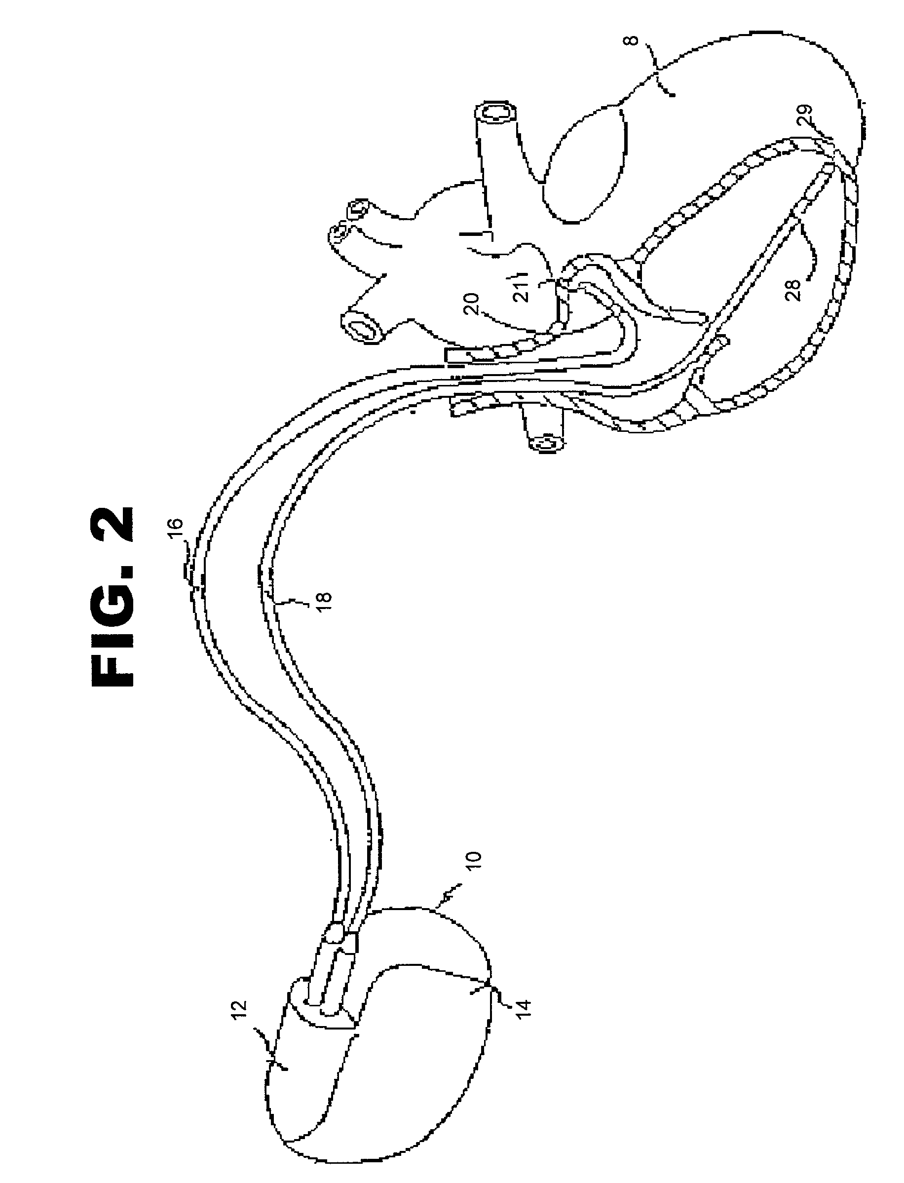 Rate adaptive pacemaker system with dual sensing component and method of using same
