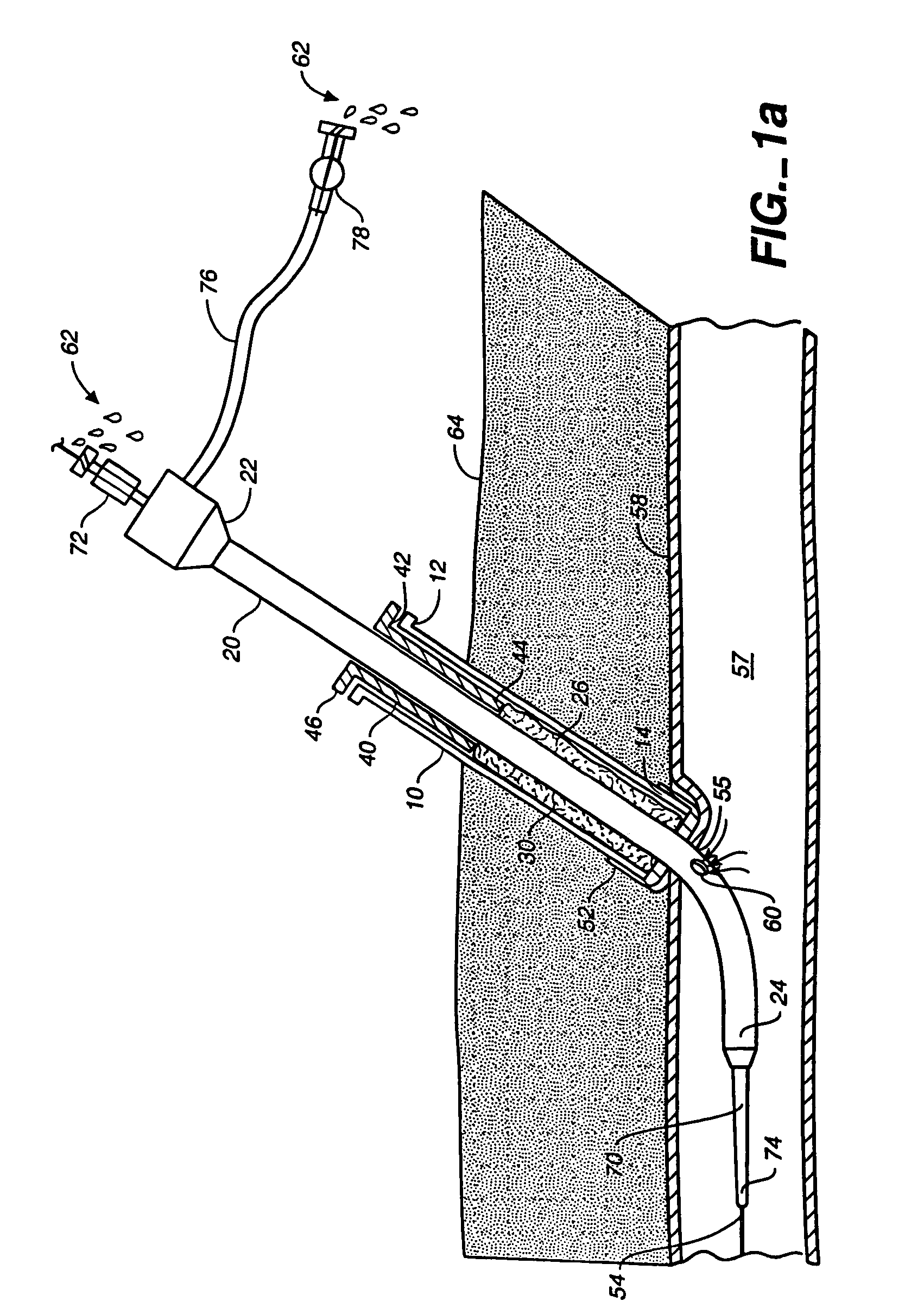 Sheath-mounted arterial plug delivery device