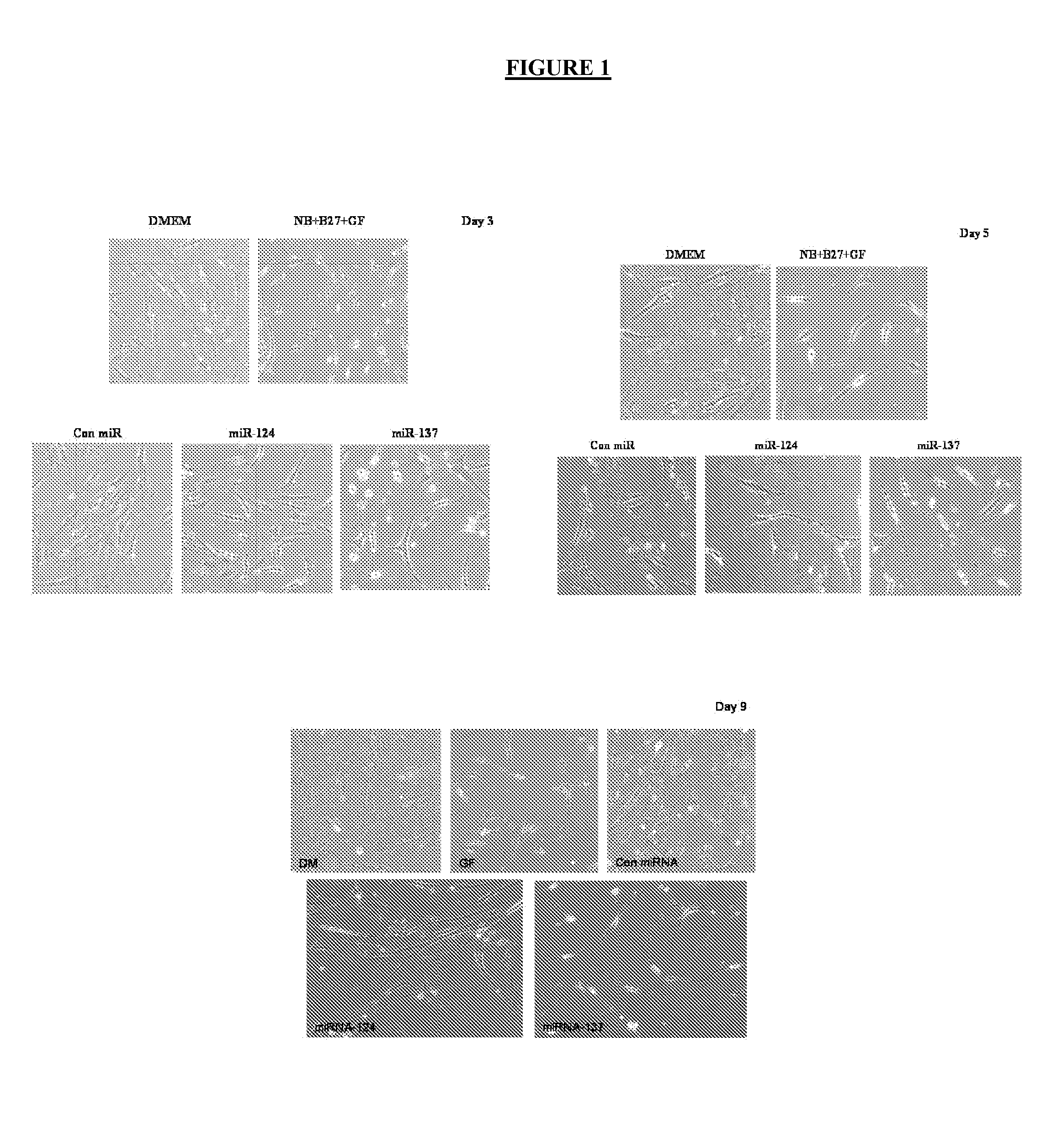 Methods, systems, and compositions for neuronal differentiation of multipotent stromal cells