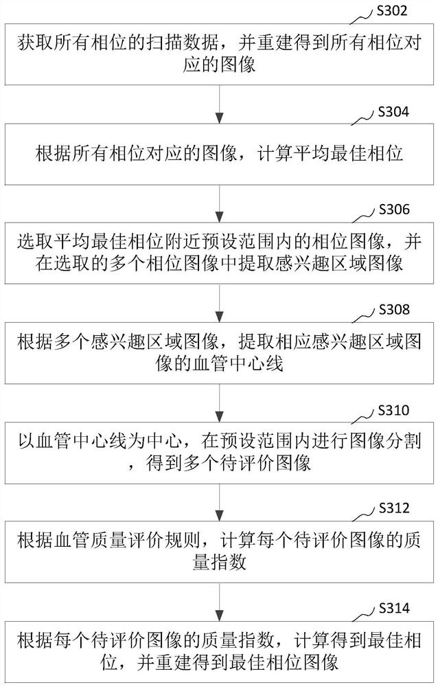 Image quality evaluation method, device, computer equipment and storage medium