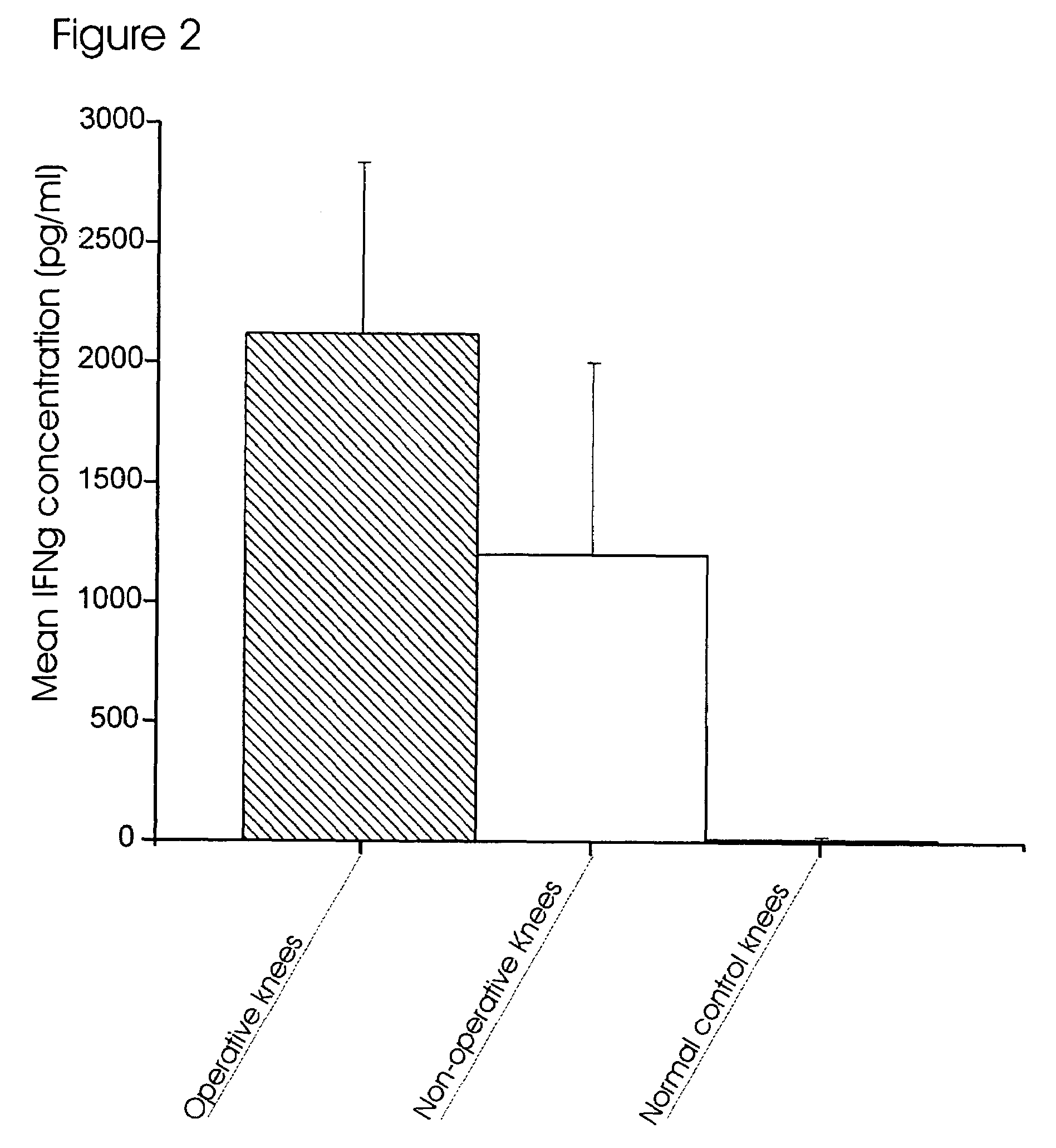 Method for diagnosing and treating acute joint injury