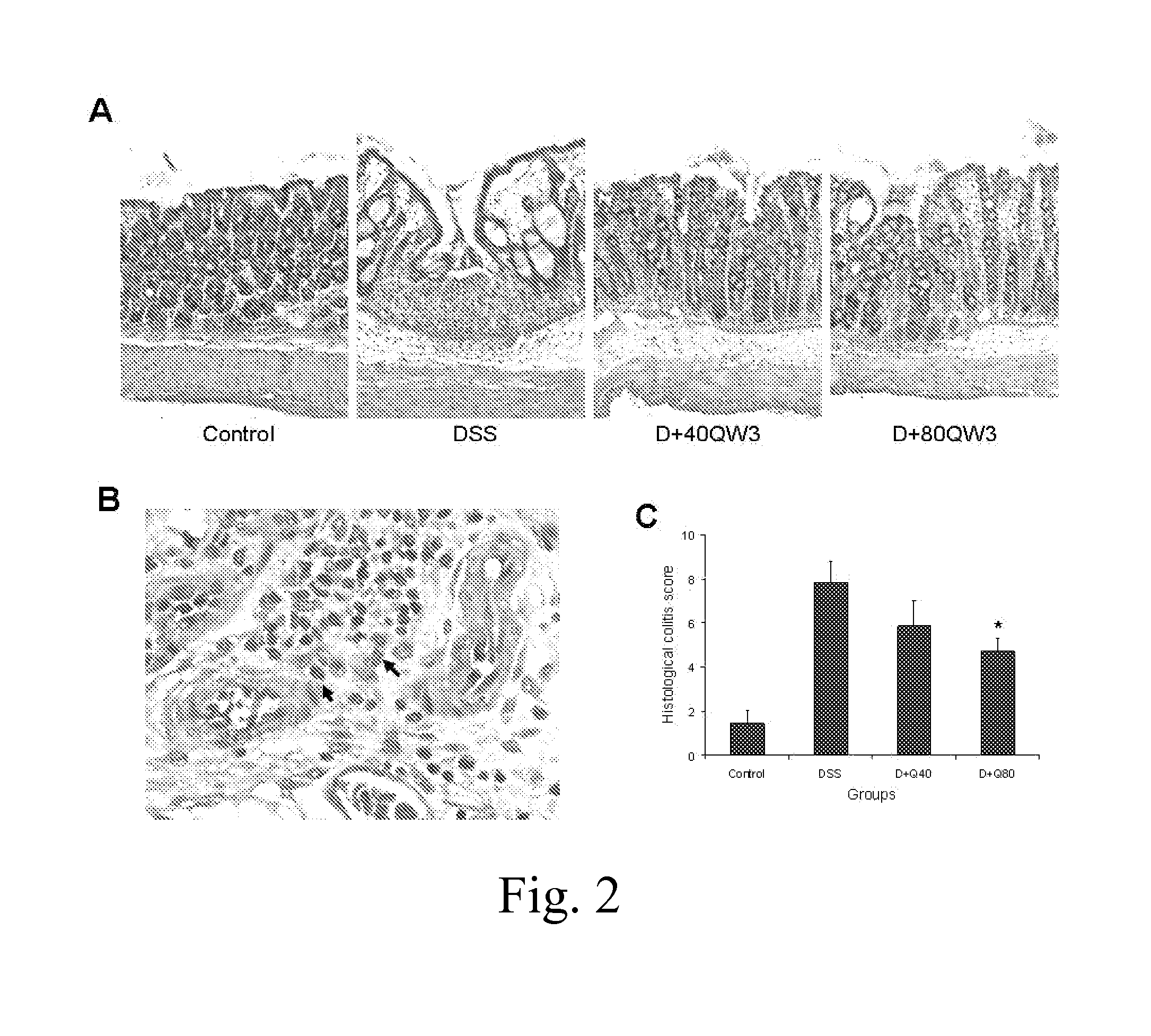 Treatment of inflammatory bowel diseases using a tripeptide