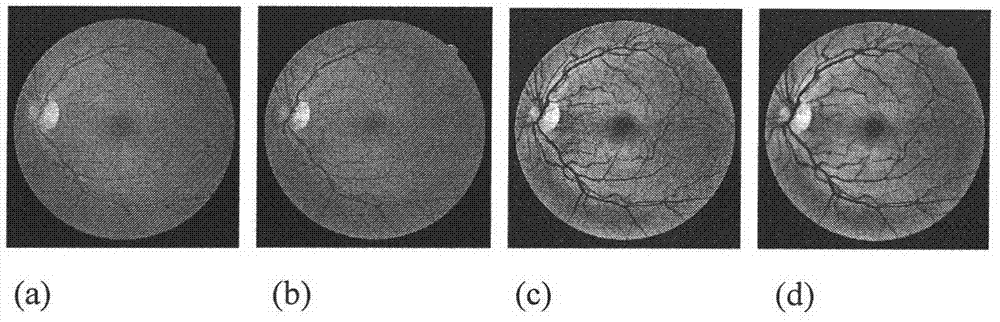 A Vessel Segmentation Method of Fundus Image Based on Adaptive Difference of Gaussian