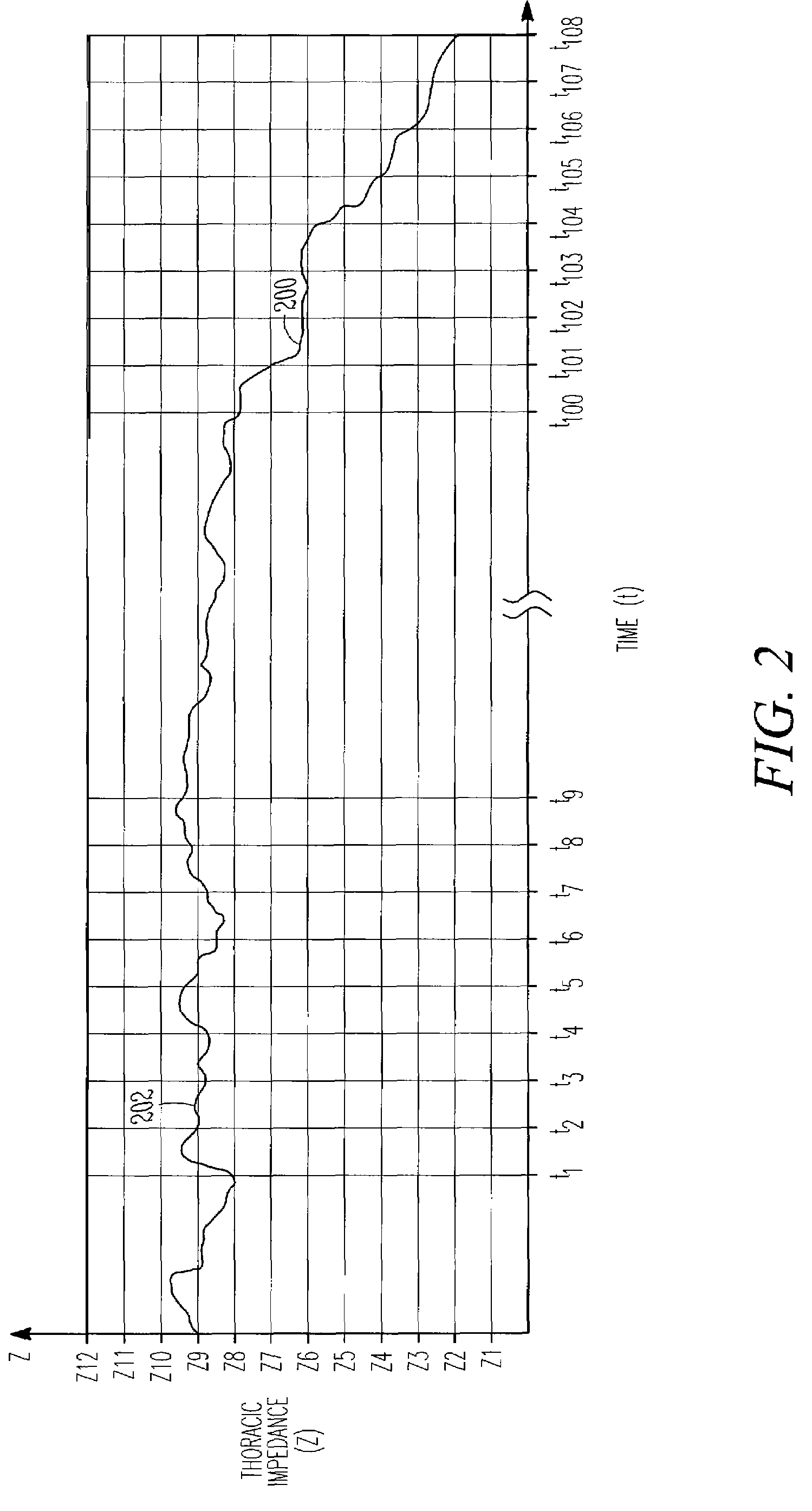 Monitoring fluid in a subject using an electrode configuration providing negative sensitivity regions