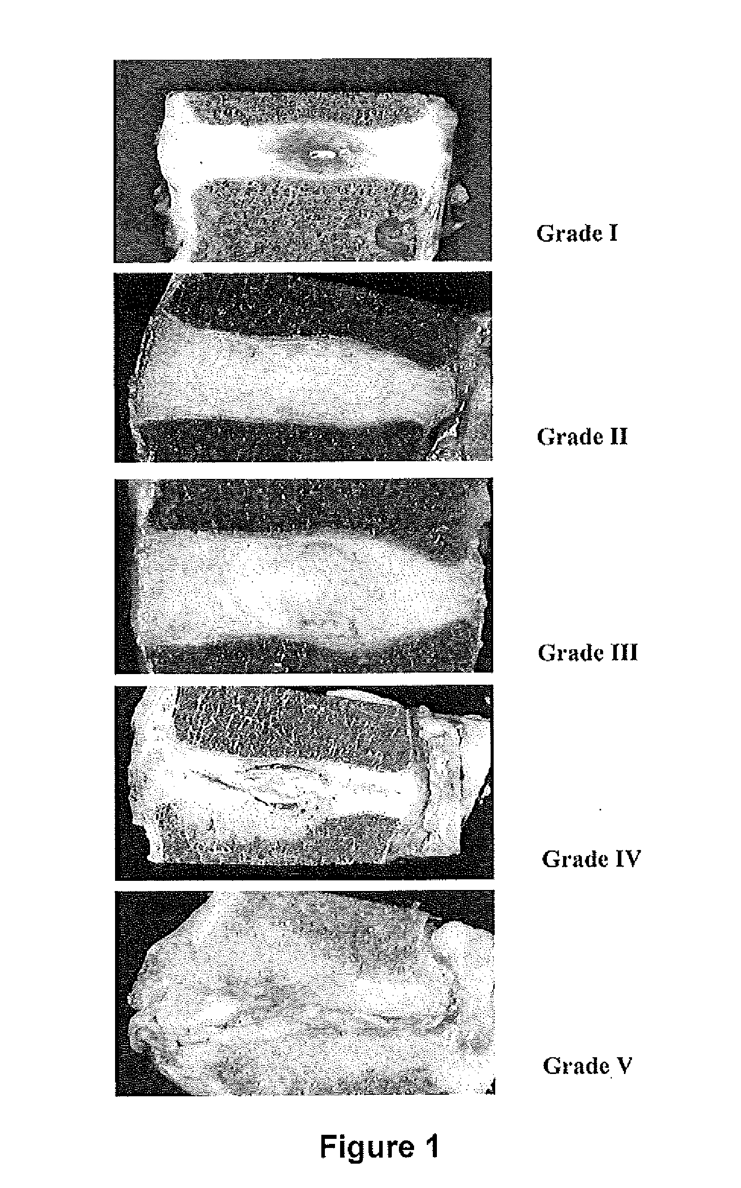 Compositions and Methods for Treating a Disorder or Defect in Soft Tissue