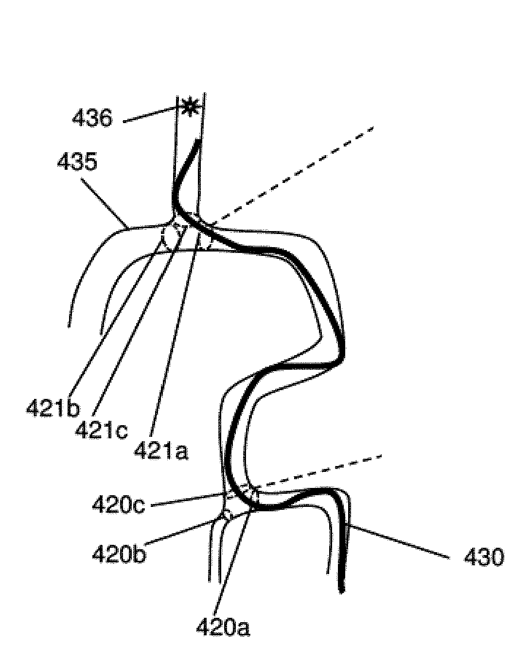 Systems and Methods for Routing a Vessel Line Such as a Catheter Within a Vessel