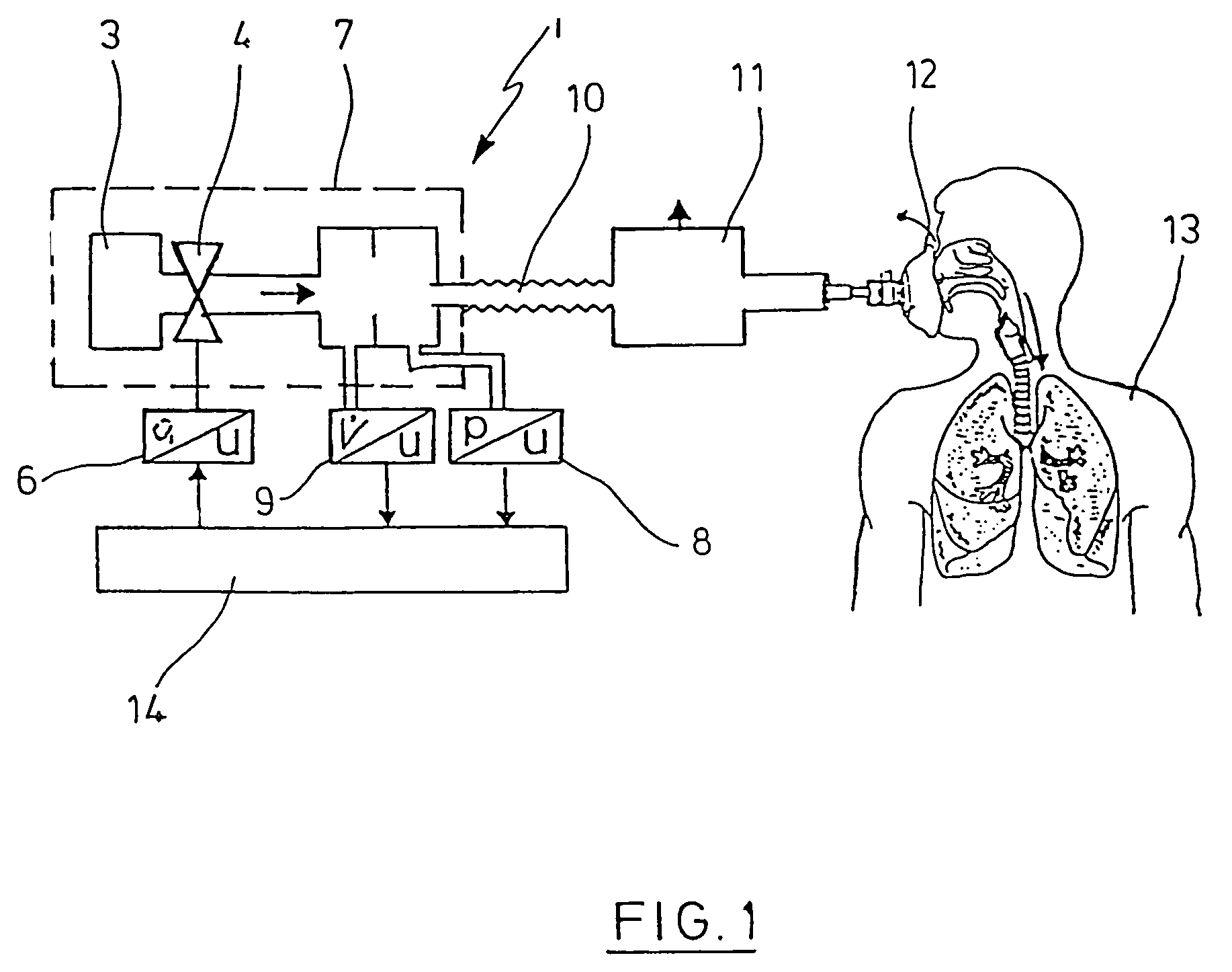 Method and device for detecting leaks in respiratory gas supply systems