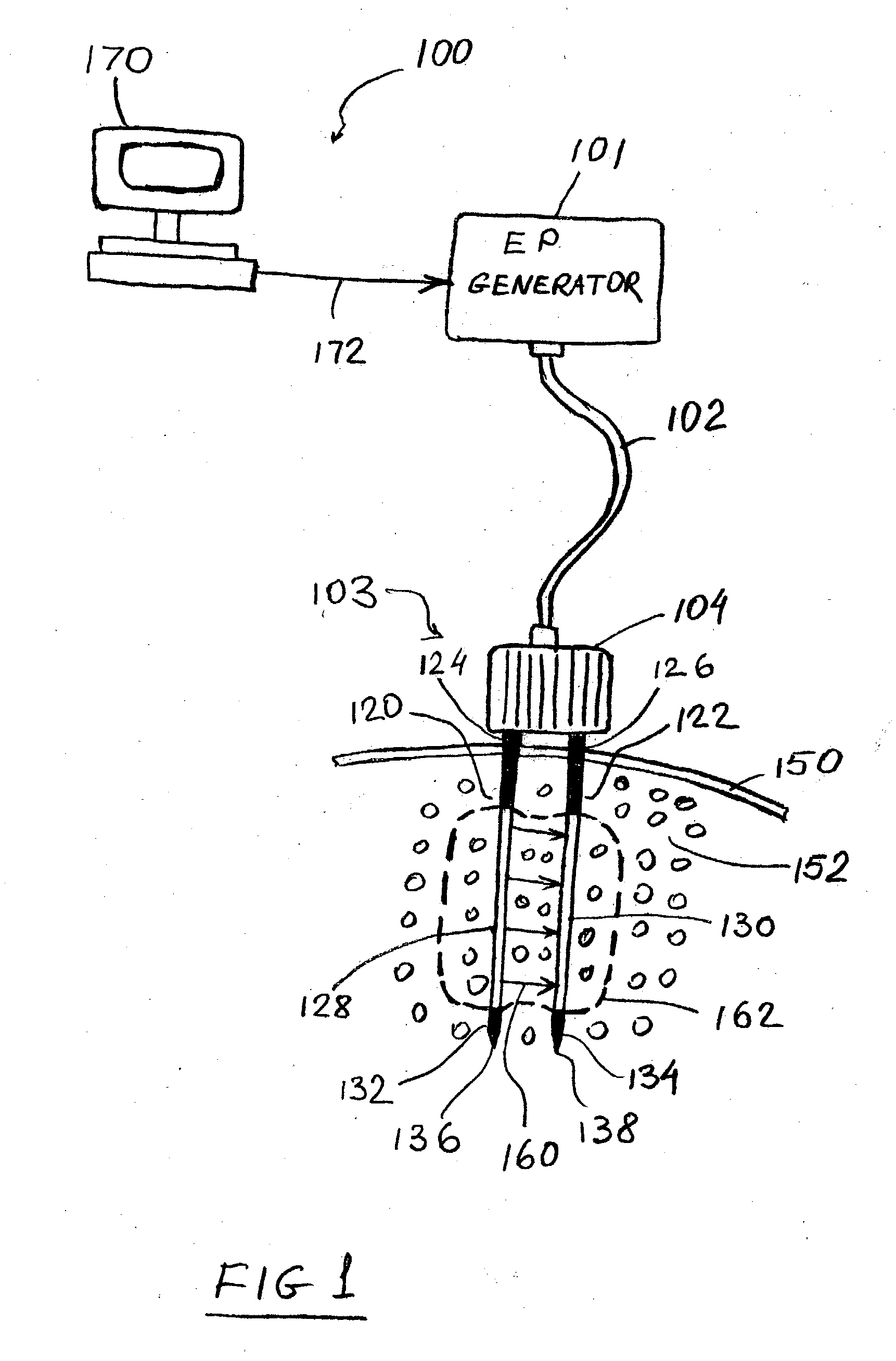 Apparatus and method for reducing subcutaneous fat deposits by electroporation