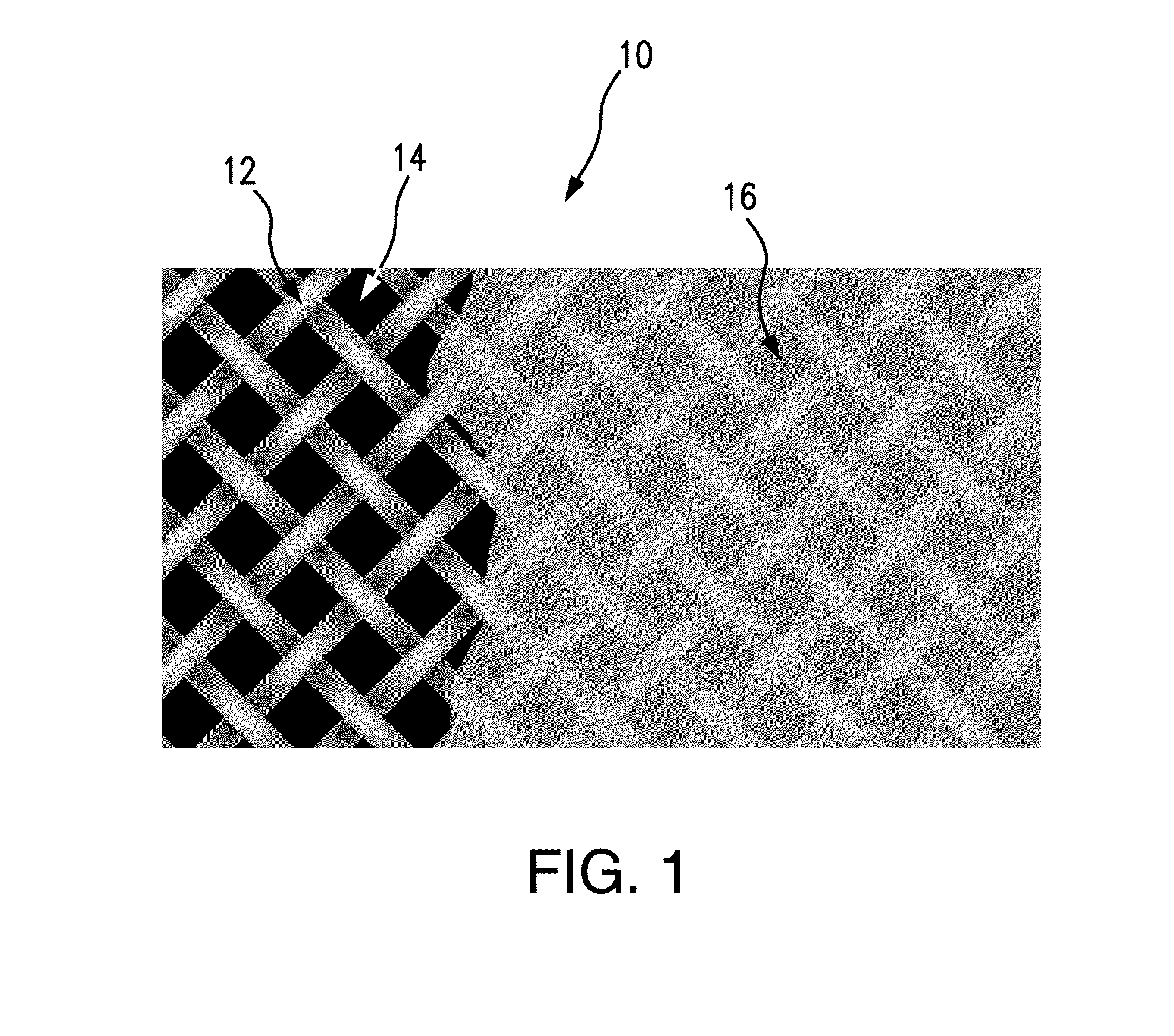 Surgical sutures incorporated with stem cells or other bioactive materials
