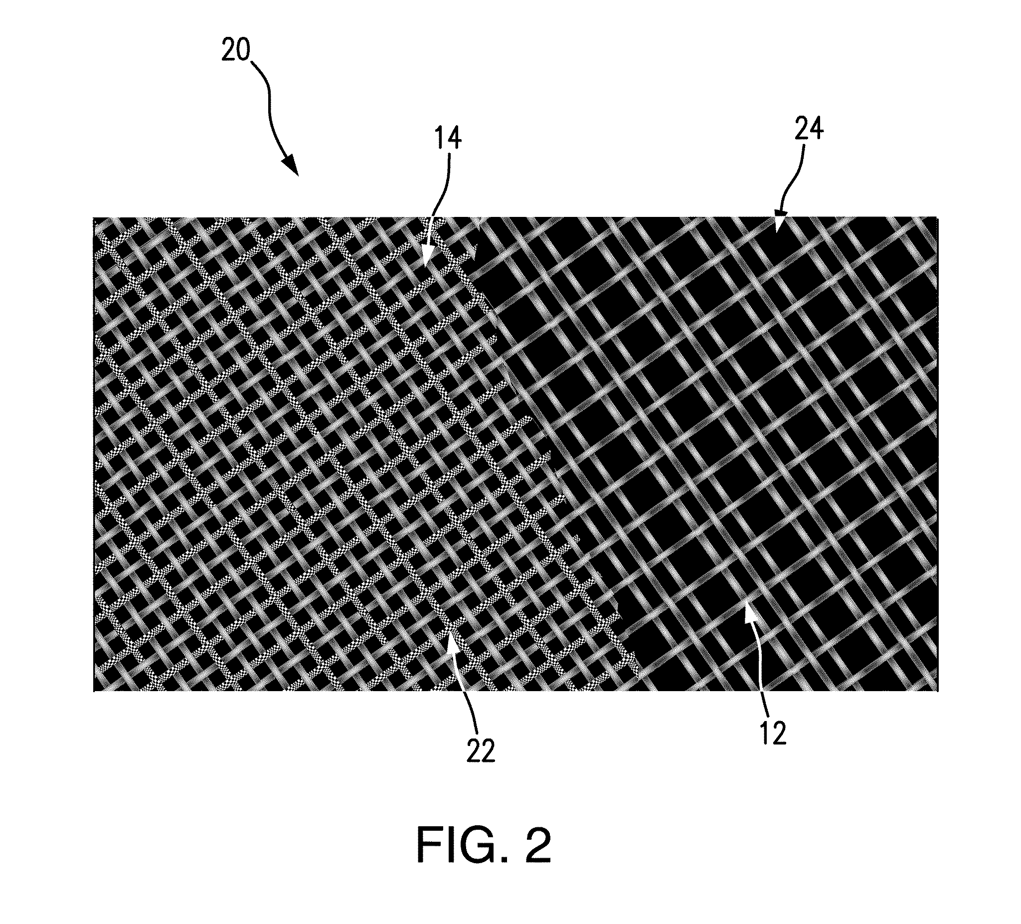 Surgical sutures incorporated with stem cells or other bioactive materials