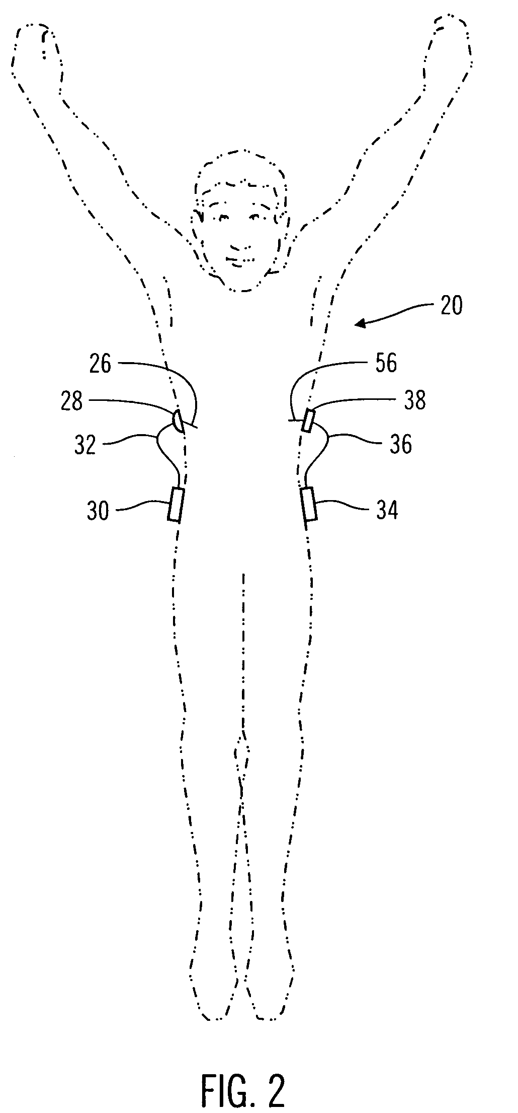 Closed-loop method for controlling insulin infusion