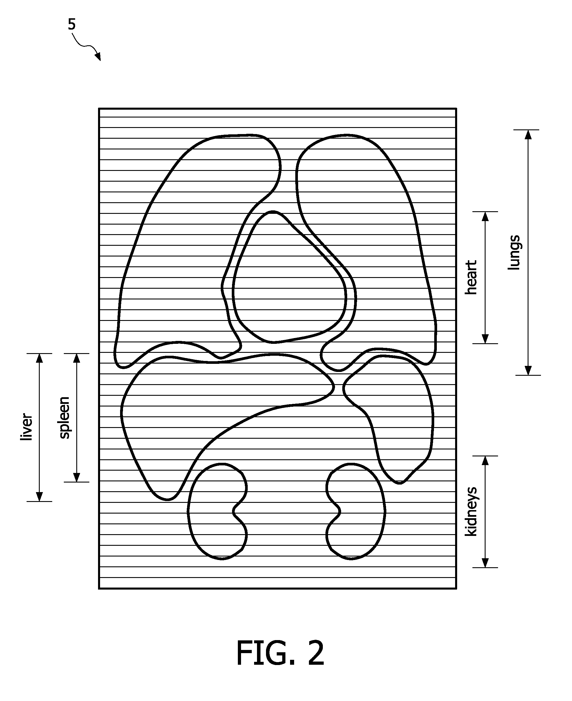 Method of retrieving data from a medical image data set