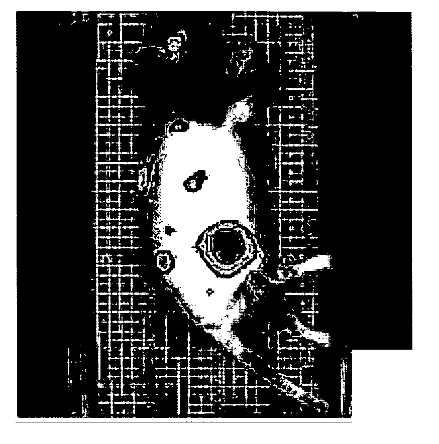 Bone treatment instrument and method