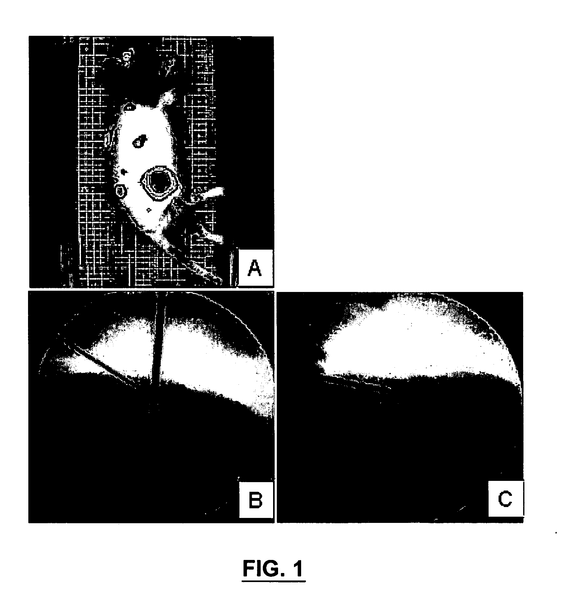 Bone treatment instrument and method