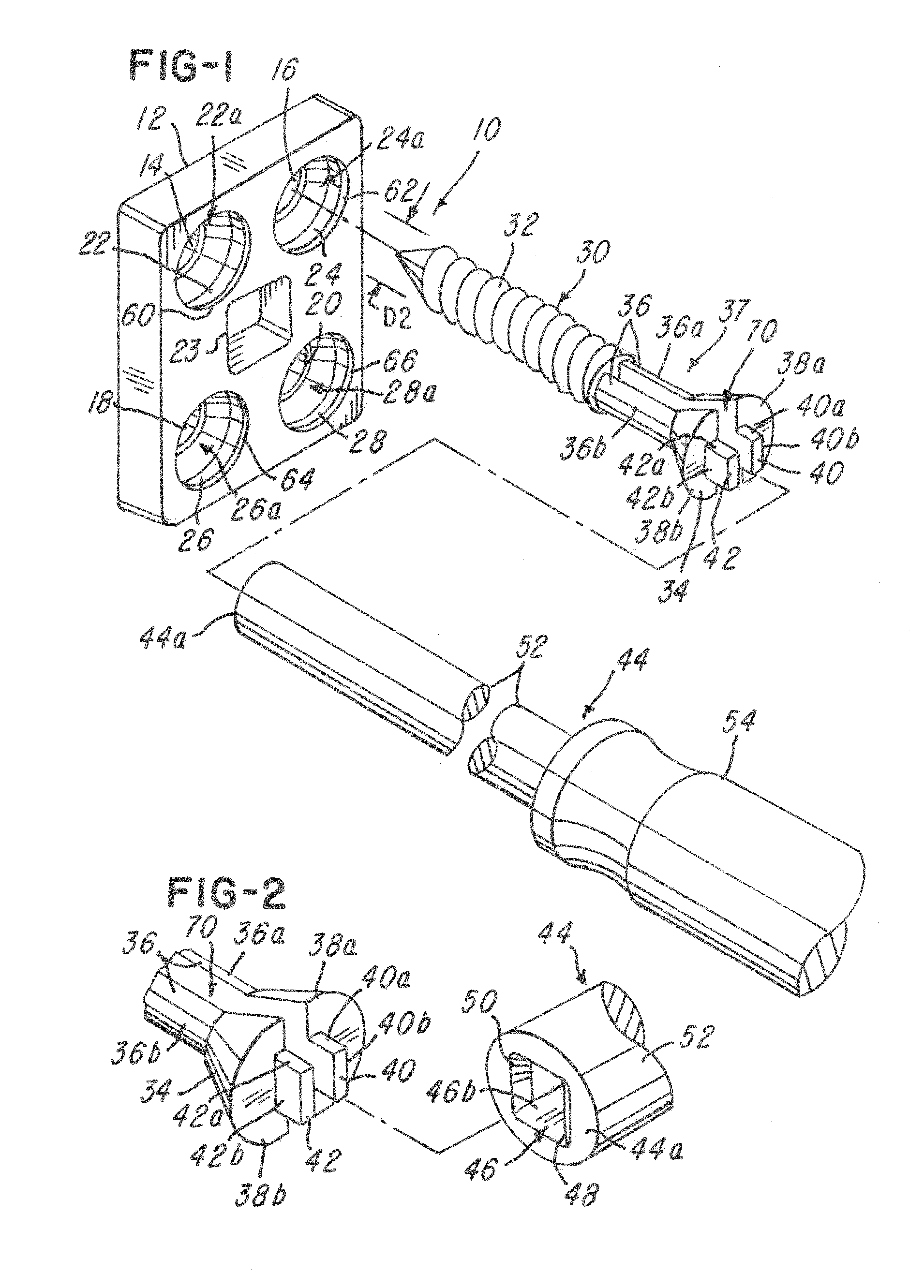 Screw implant and system and method for locking a screw in an implant plate