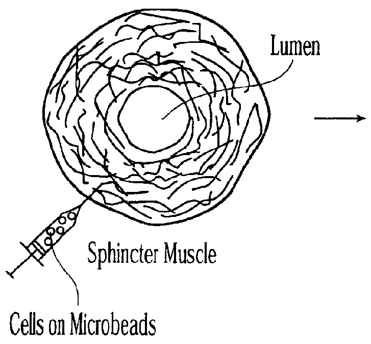 Injectable microspheres for dermal augmentation and tissue bulking