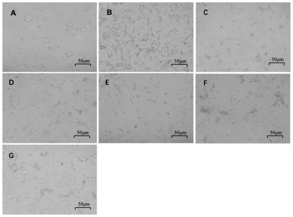 Antiviral pharmaceutical composition, method for inhibiting in-vitro virus activity and application of antiviral pharmaceutical composition