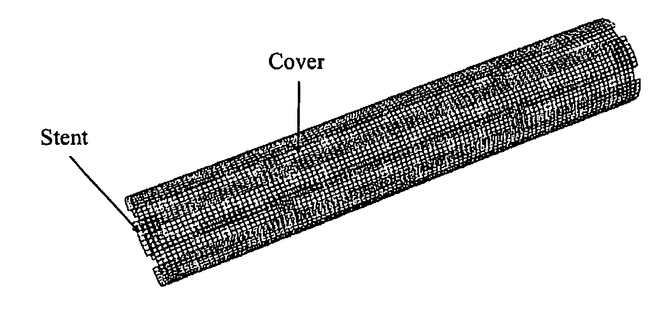 Tubular Polymer Stent Coverings