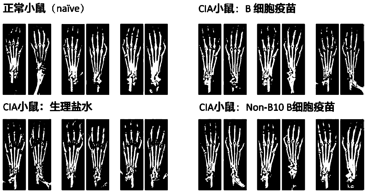 Application of B cell vaccine in preparation of drugs for treating rheumatoid arthritis