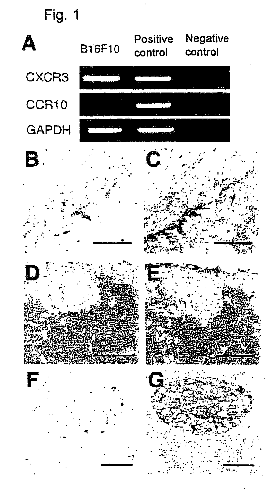 Pharmaceutical composition comprising cxcr3 inhibitor