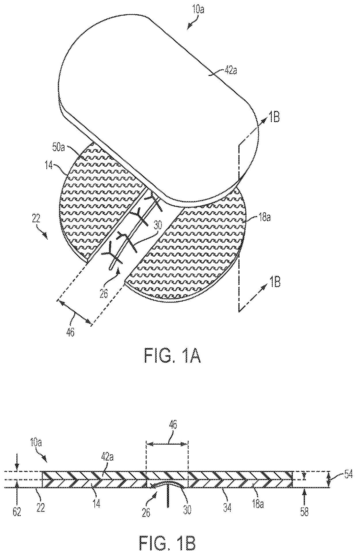 Apparatuses and methods for minimizing wound dehiscense, scar spread, and/or the like