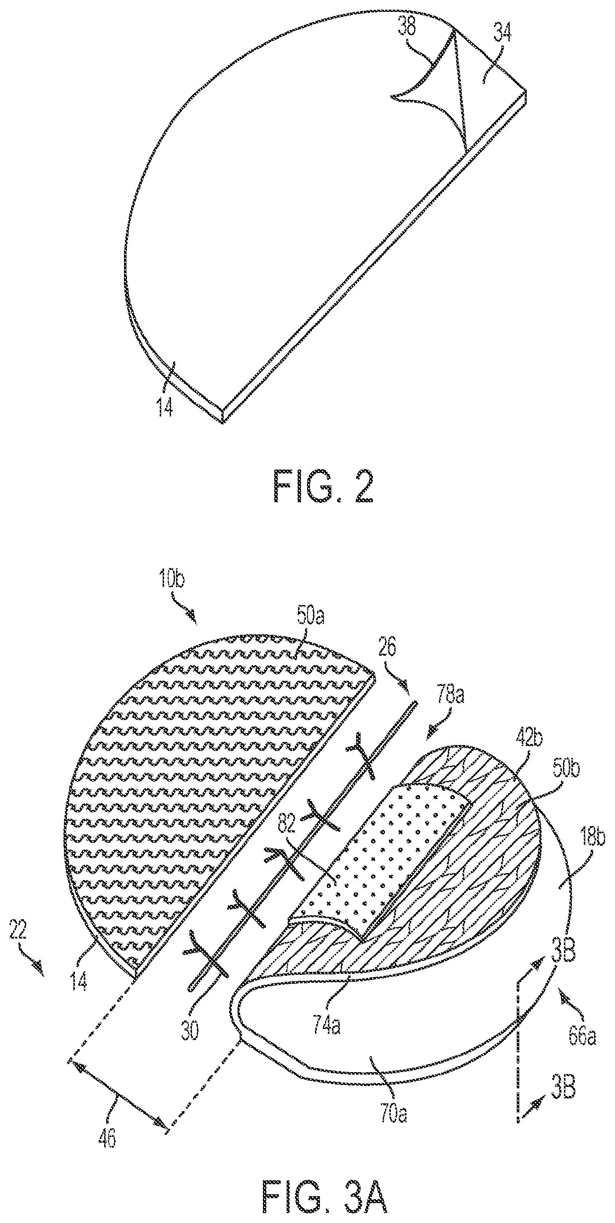 Apparatuses and methods for minimizing wound dehiscense, scar spread, and/or the like