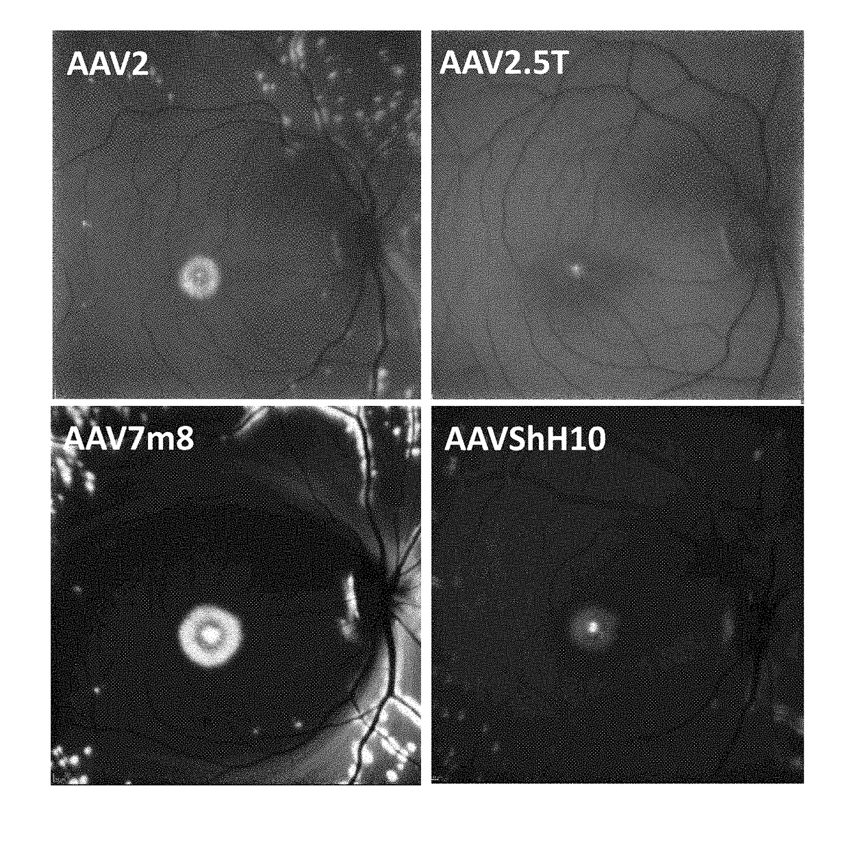 Compositions and methods for intravitreal delivery of polynucleotides to retinal cones