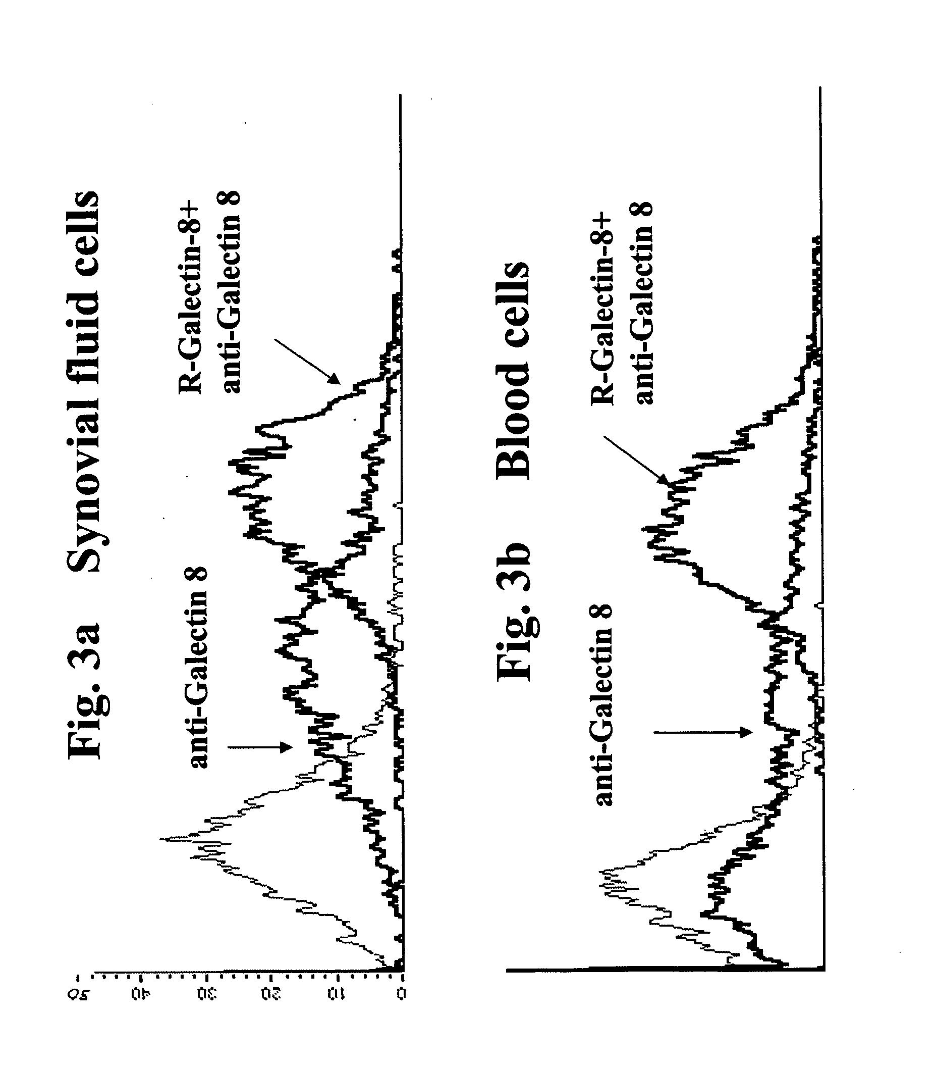 Novel galectin sequences and compositions and methods utilizing same for treating or diagnosing arthritis and other chronic inflammatory diseases