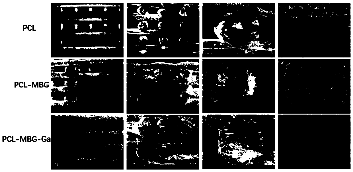 Gallium-contained polycaprolactone/bioglass porous bone repair 3D printing support and application thereof in infectious bone defect repair