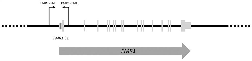 Method and kit for detecting fragile X syndrome mutation