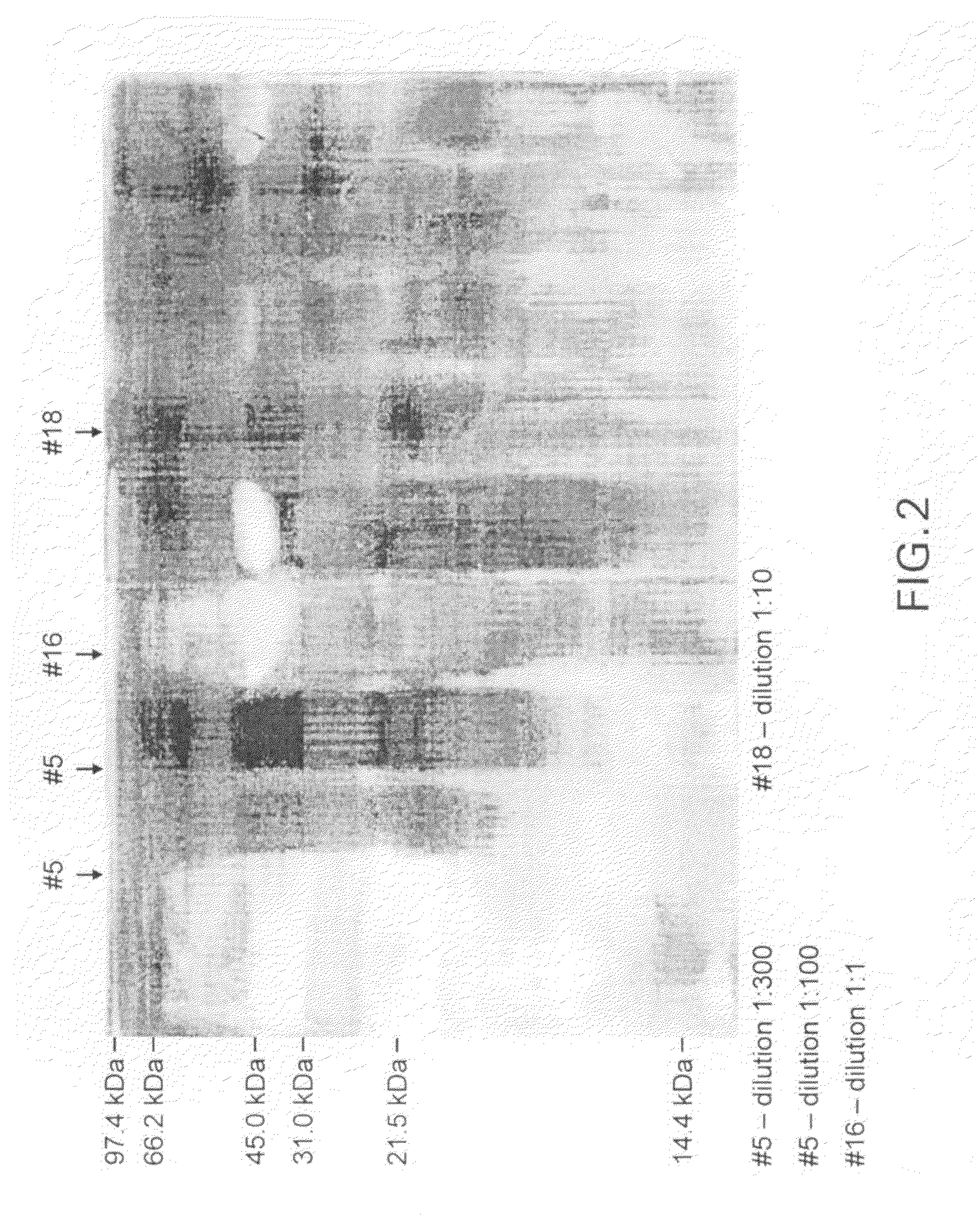 Inactivated pepsin fragments for modulating immune system activity against human malignant tumor cells