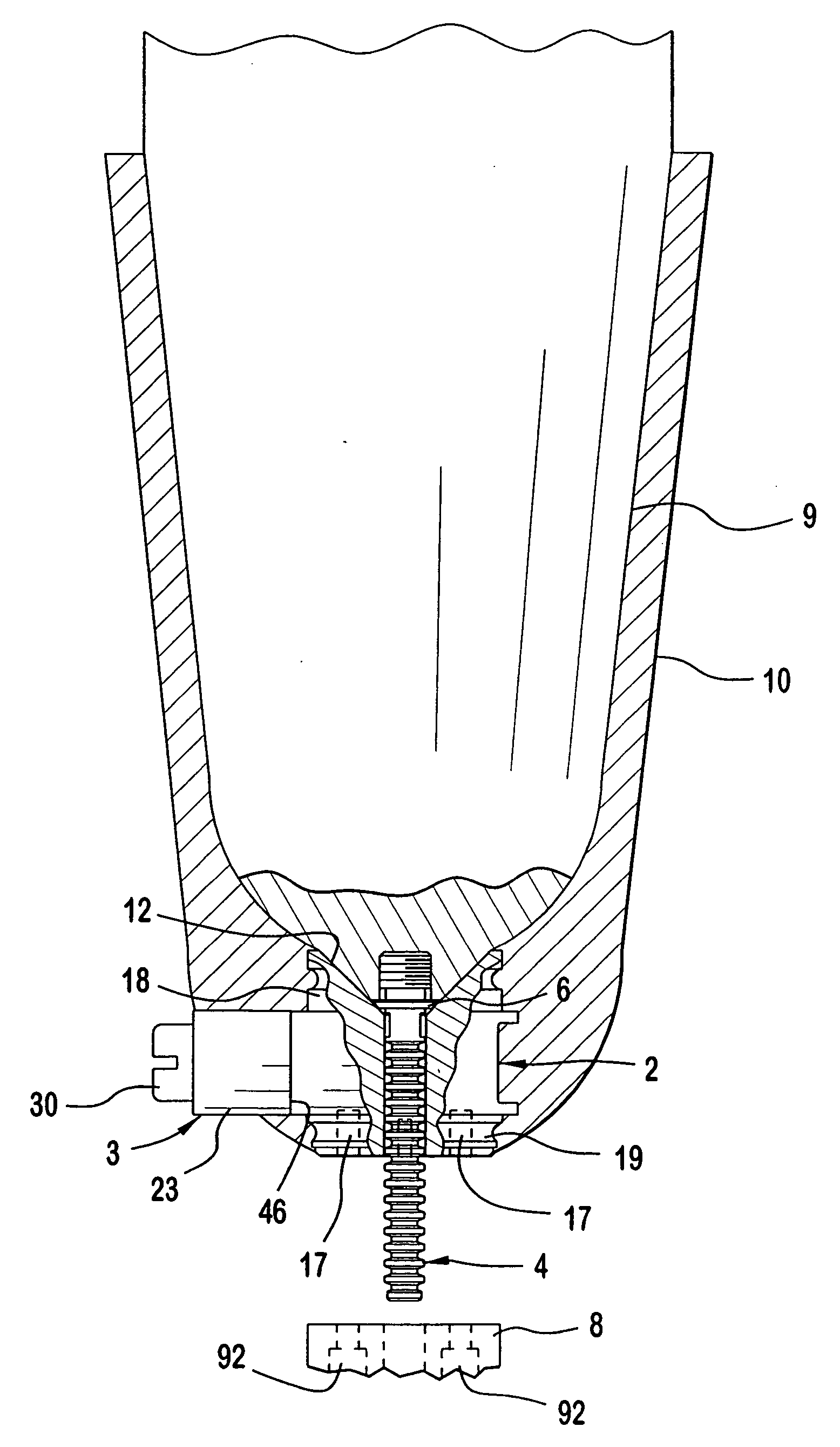 Prosthetic attachment locking device with dual locking mechanism