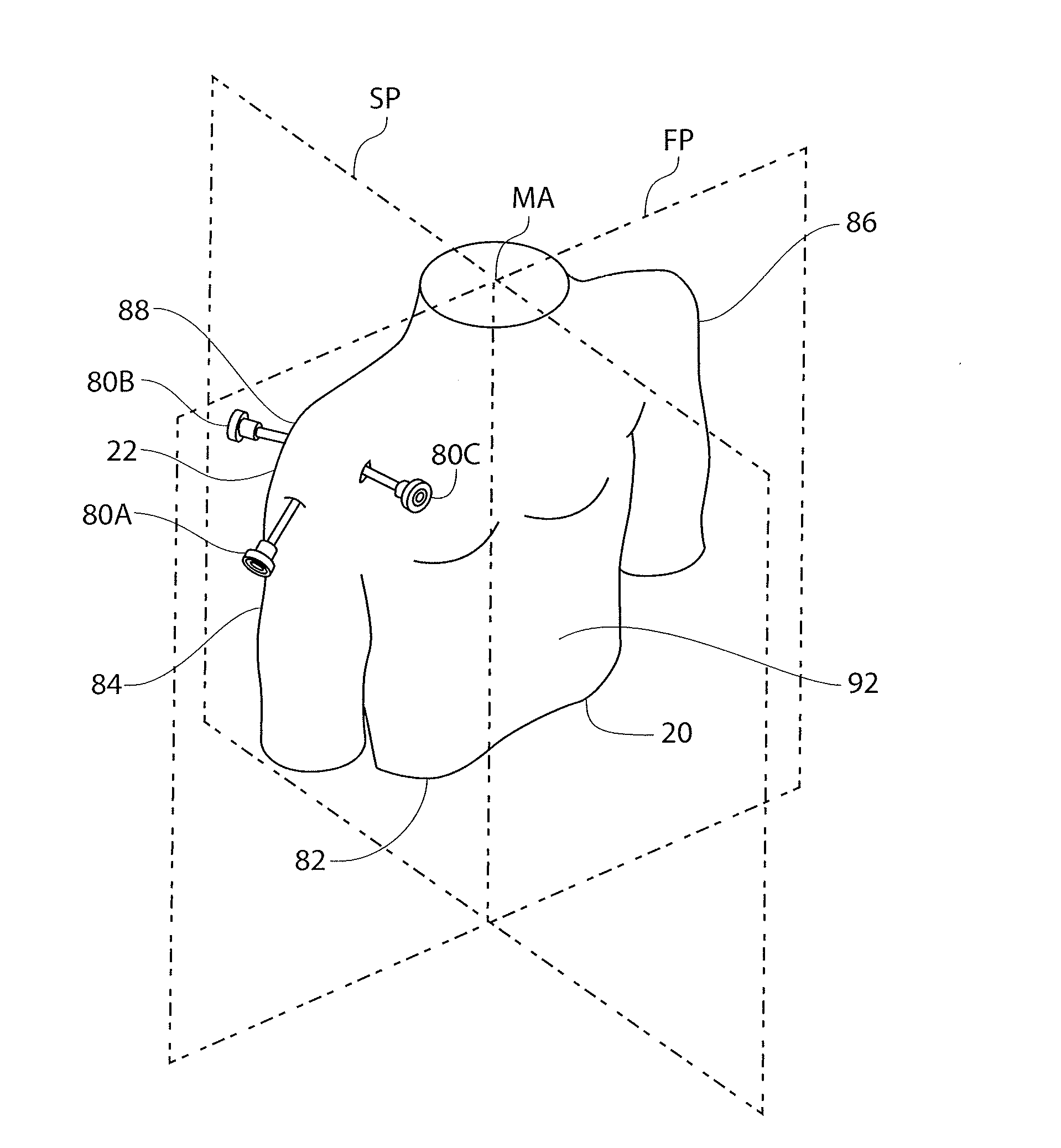 Anatomical location markers and methods of use in positioning sheet-like materials during surgery