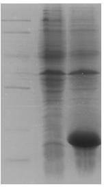 Recombinant peanut allergen and mutant and preparation method and application of recombinant peanut allergen and mutant