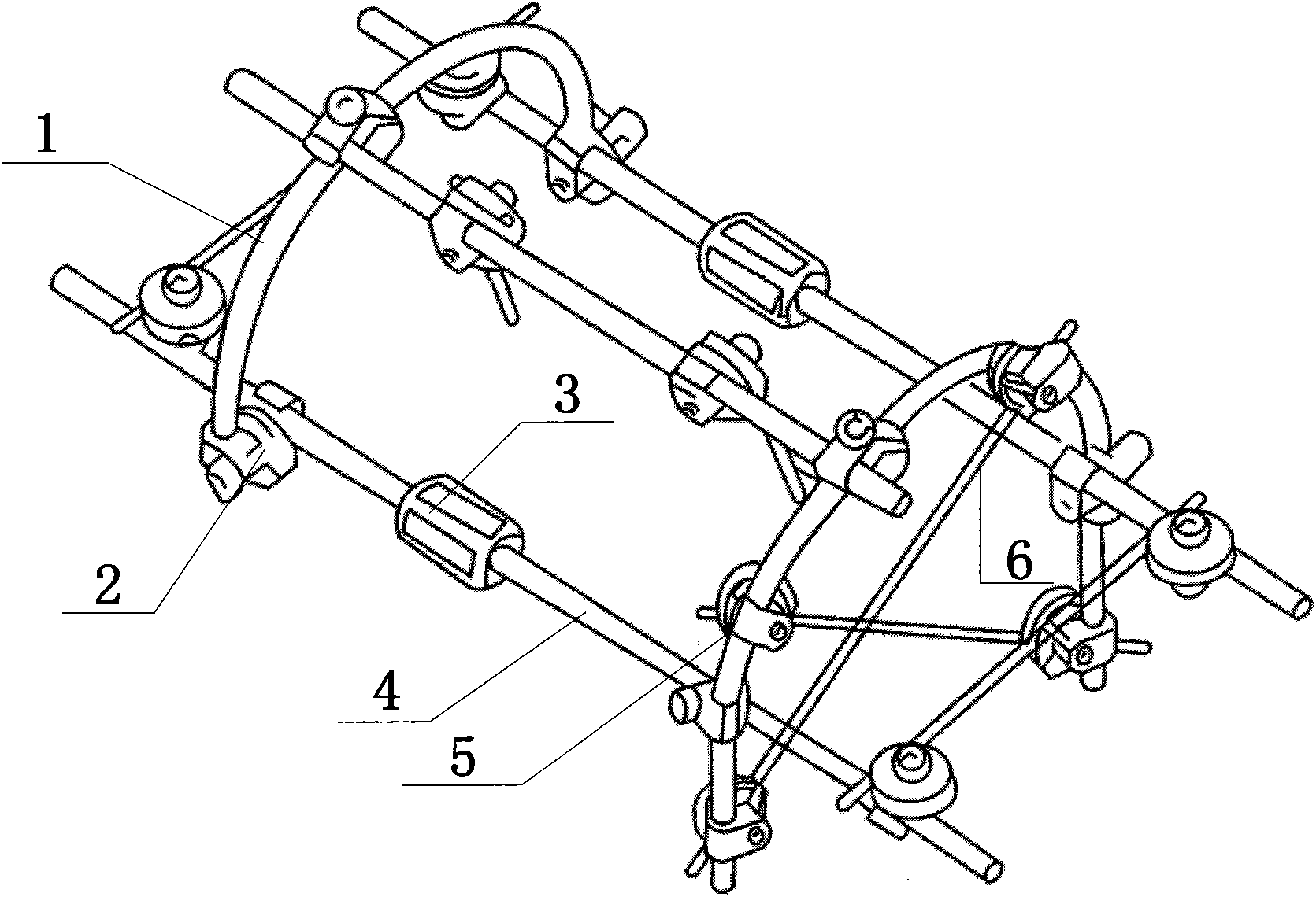 Method for fixing metaphysic bone defect by adopting thin-needle semi-ring external fixing frame and VSD (Vacuum Sealing Drainage) lavage