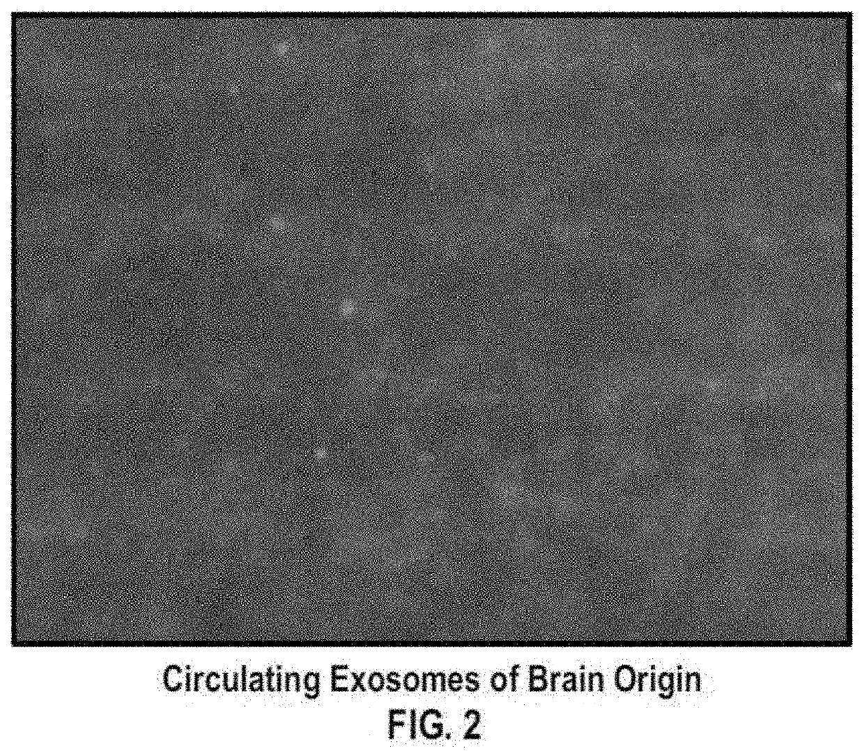 Brain specific exosome based diagnostics and extracorporeal therapies
