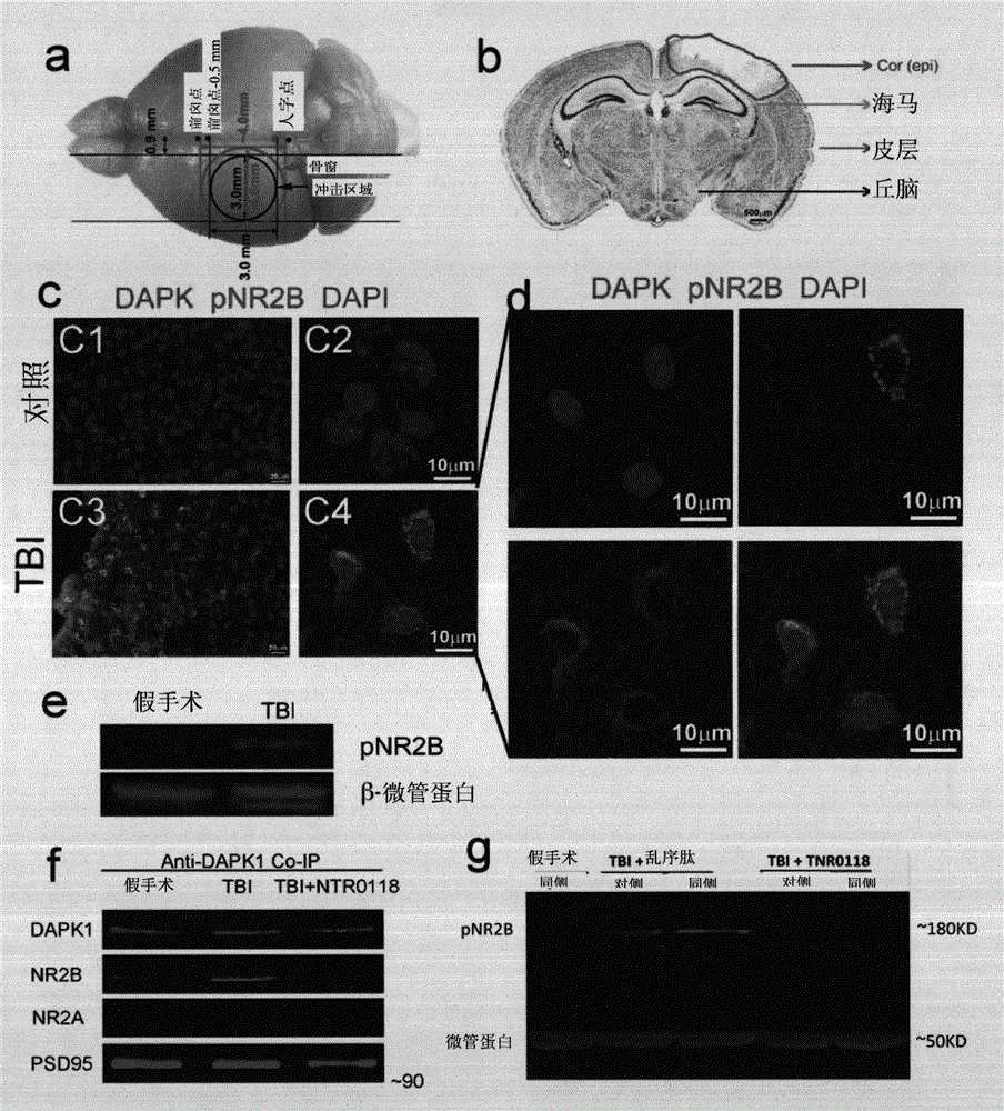 Compositions and methods for treating traumatic brain injury